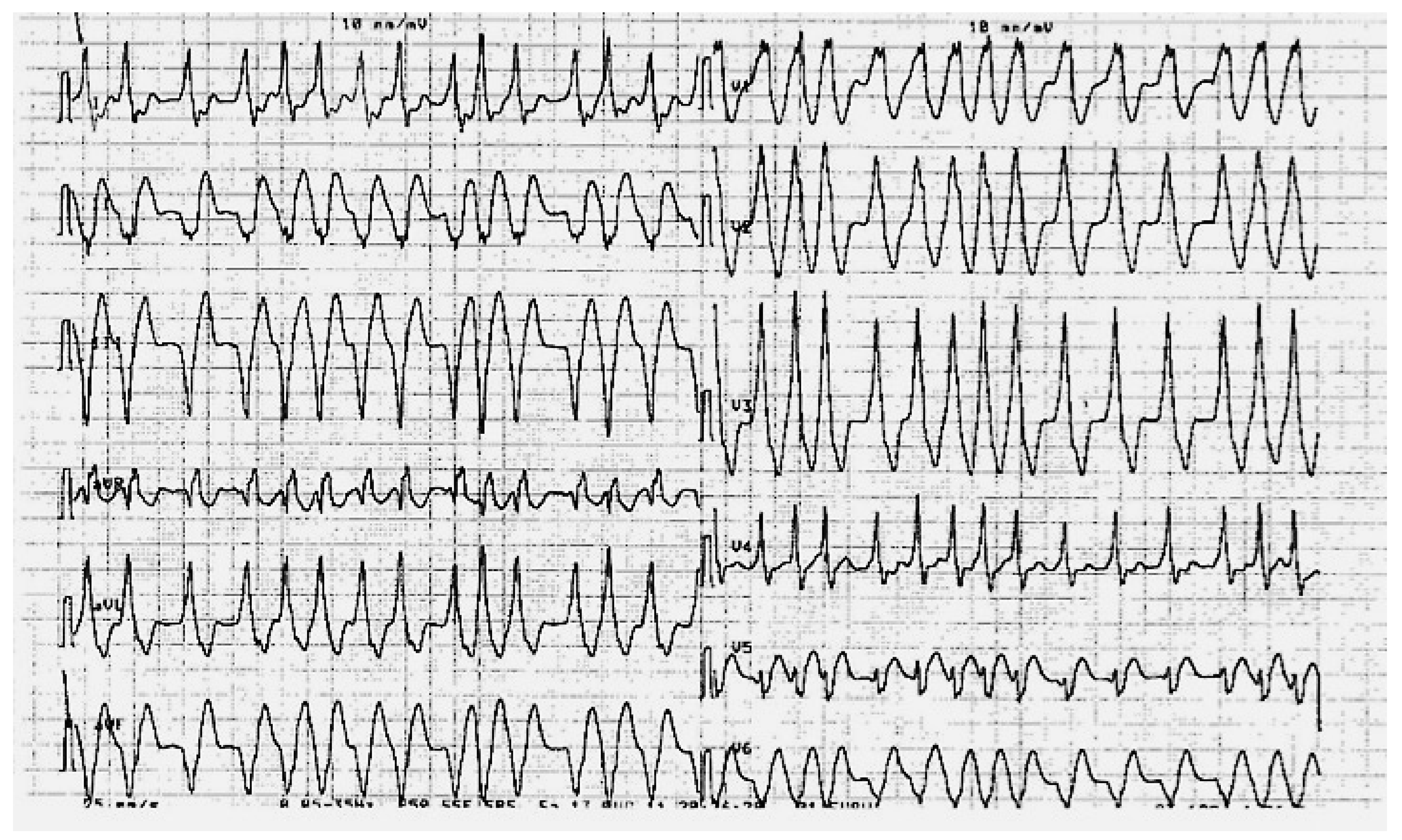Cardiovascmed 15 00233 g003
