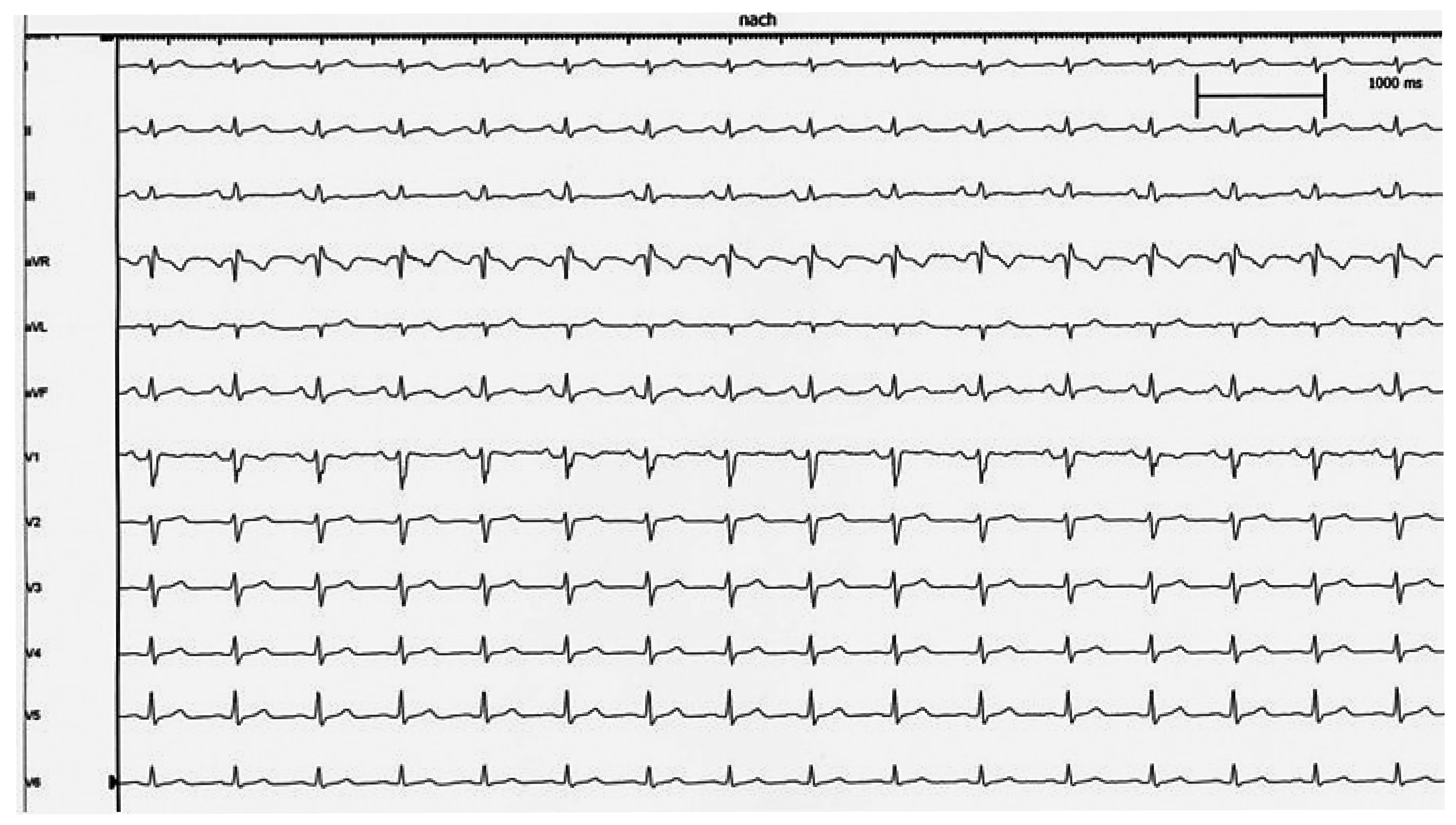 Cardiovascmed 15 00233 g004