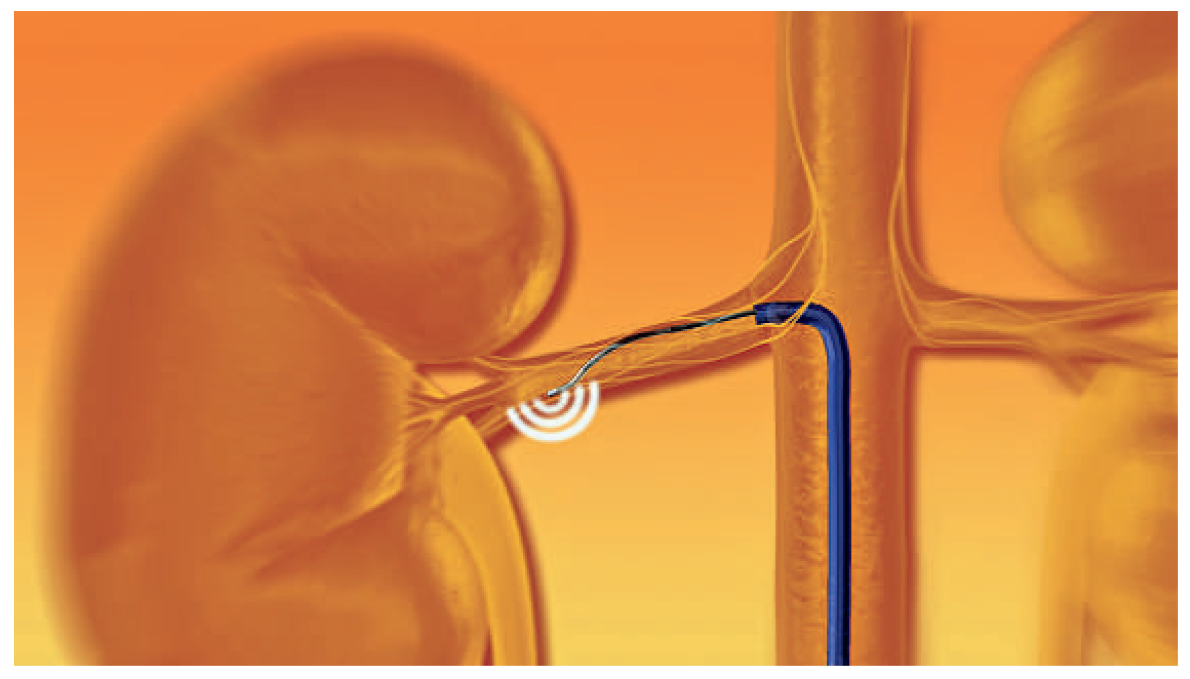 Cardiovascmed 15 00271 g001