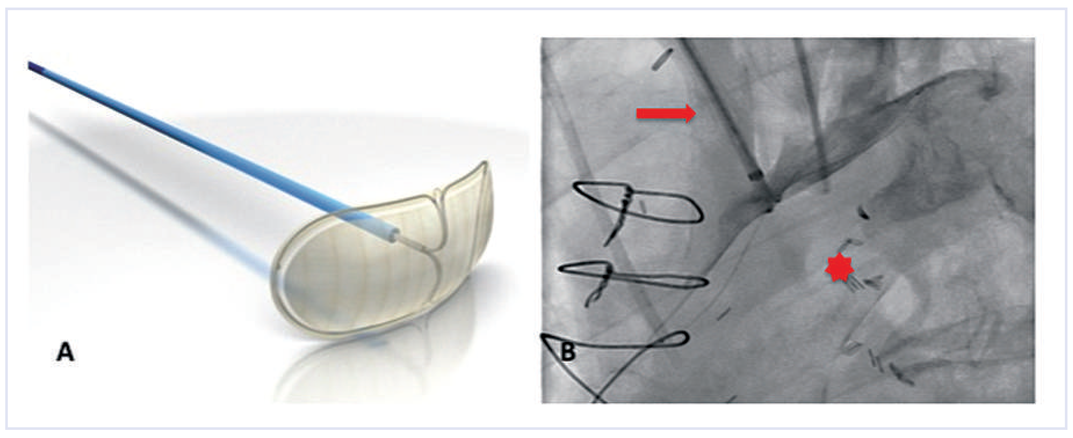 Cardiovascmed 15 00287 g001