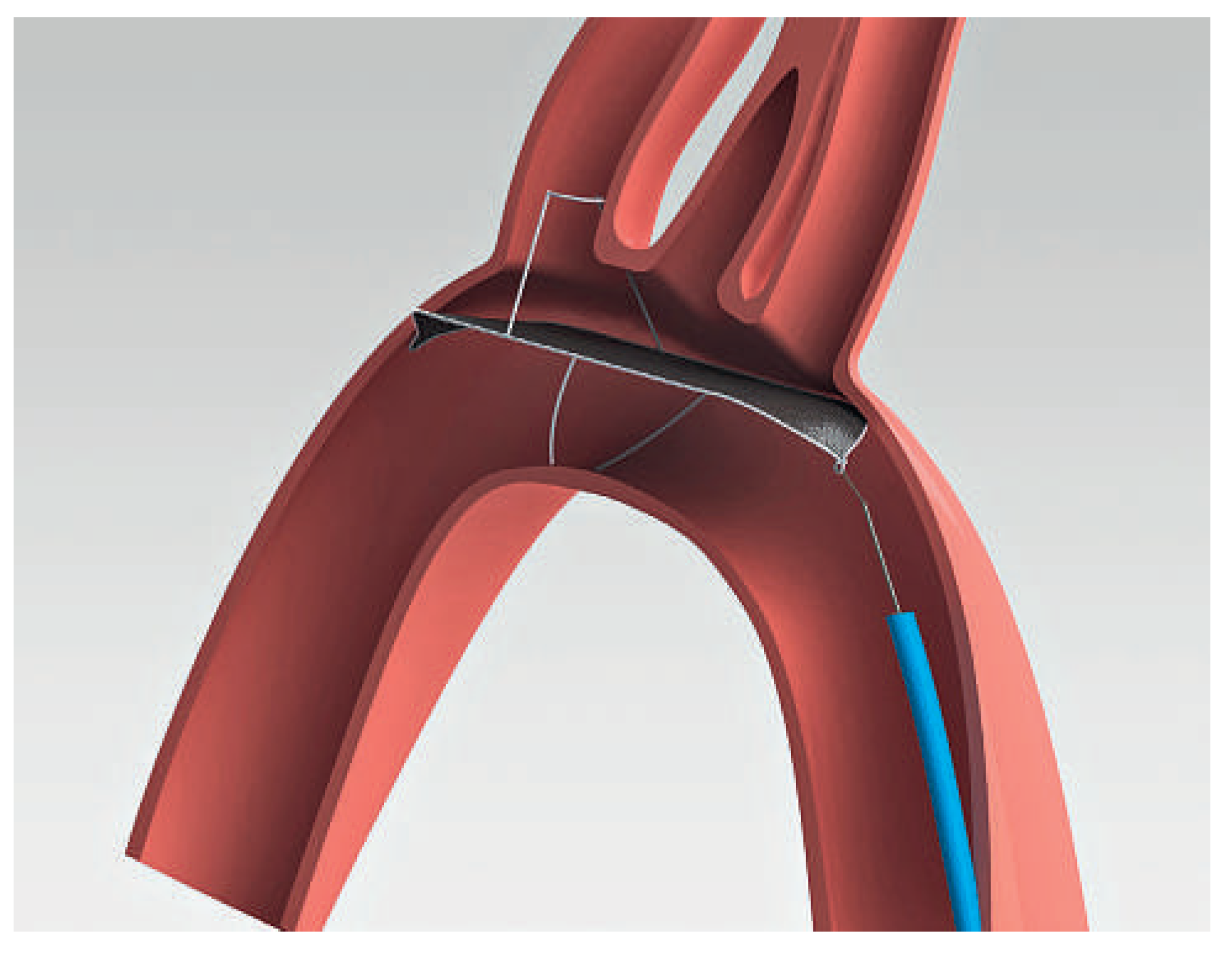 Cardiovascmed 15 00287 g003