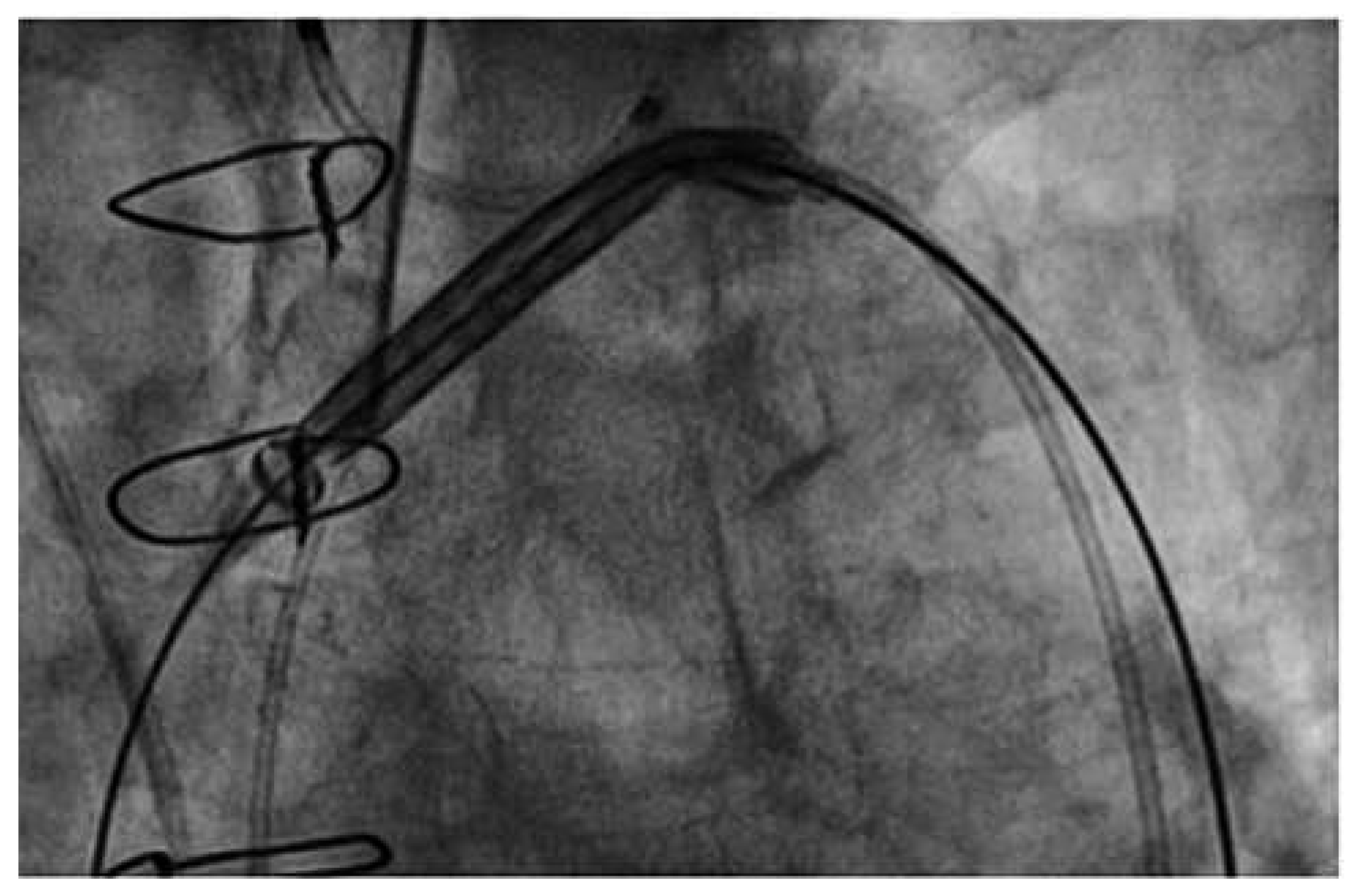 Cardiovascmed 15 00287 g006