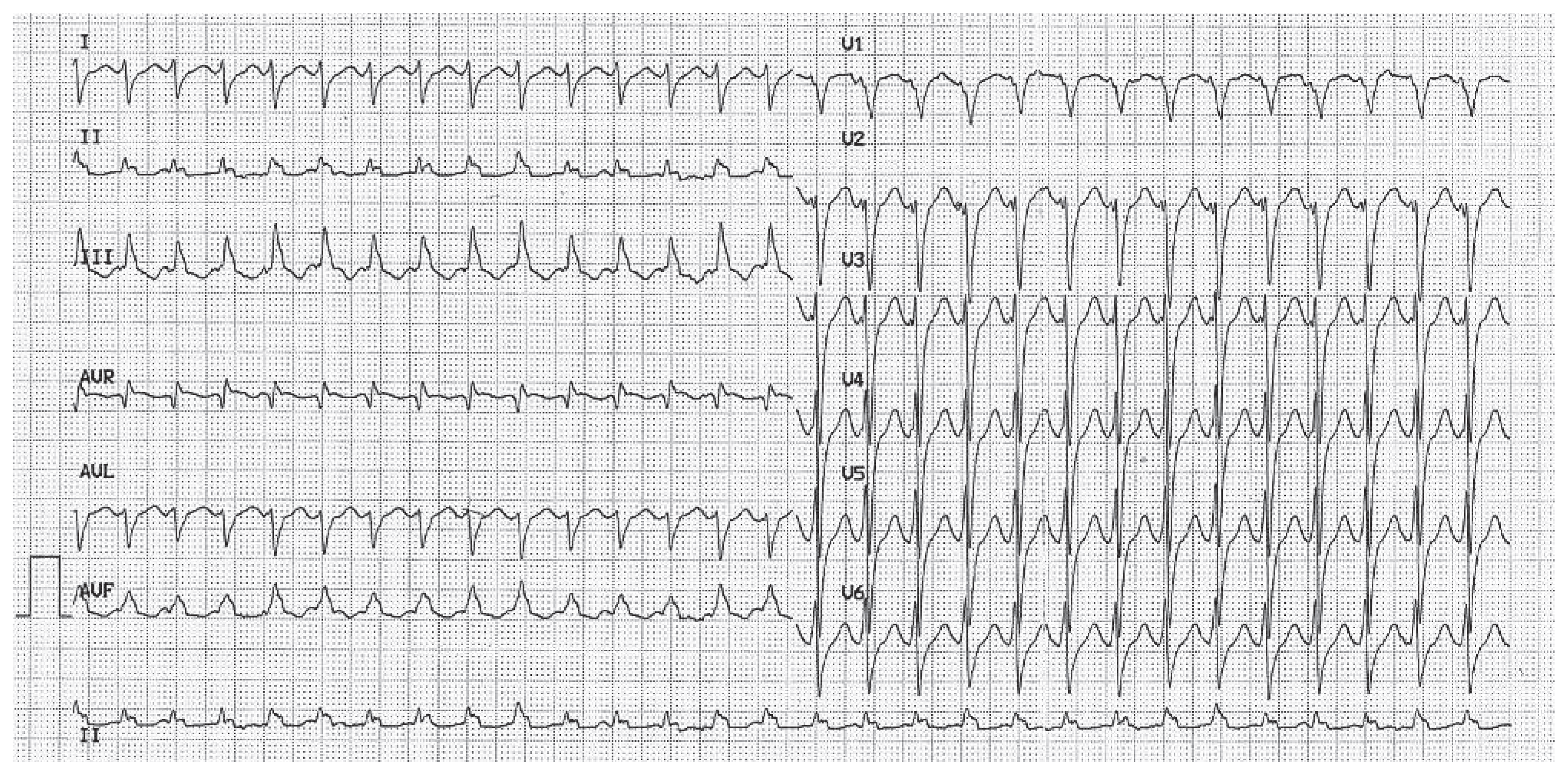 Cardiovascmed 15 00296 g001