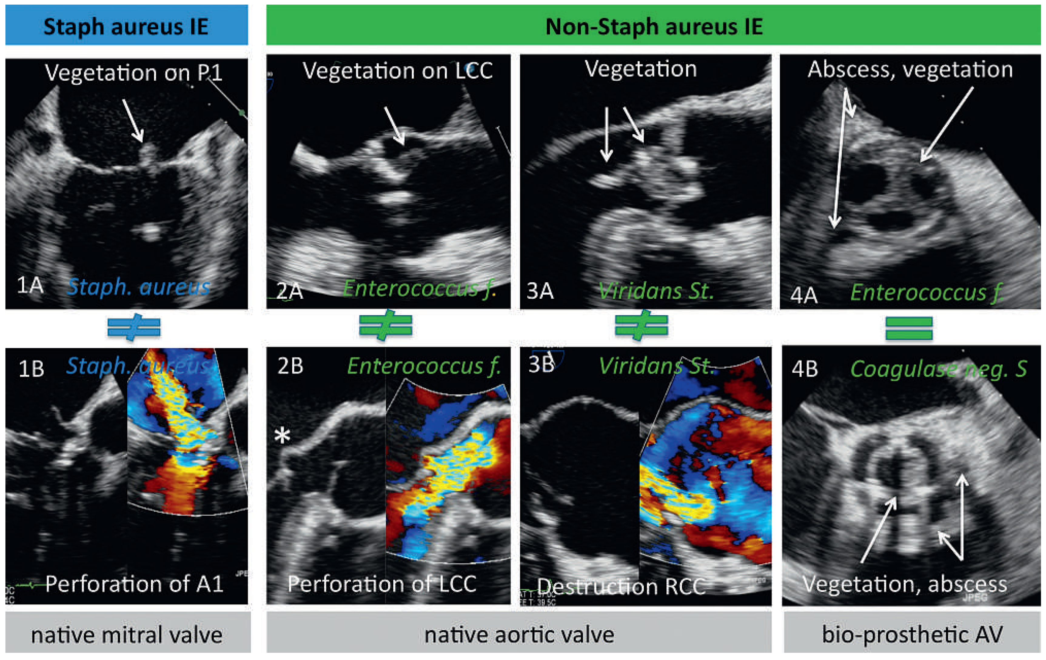 Cardiovascmed 15 00317 g003