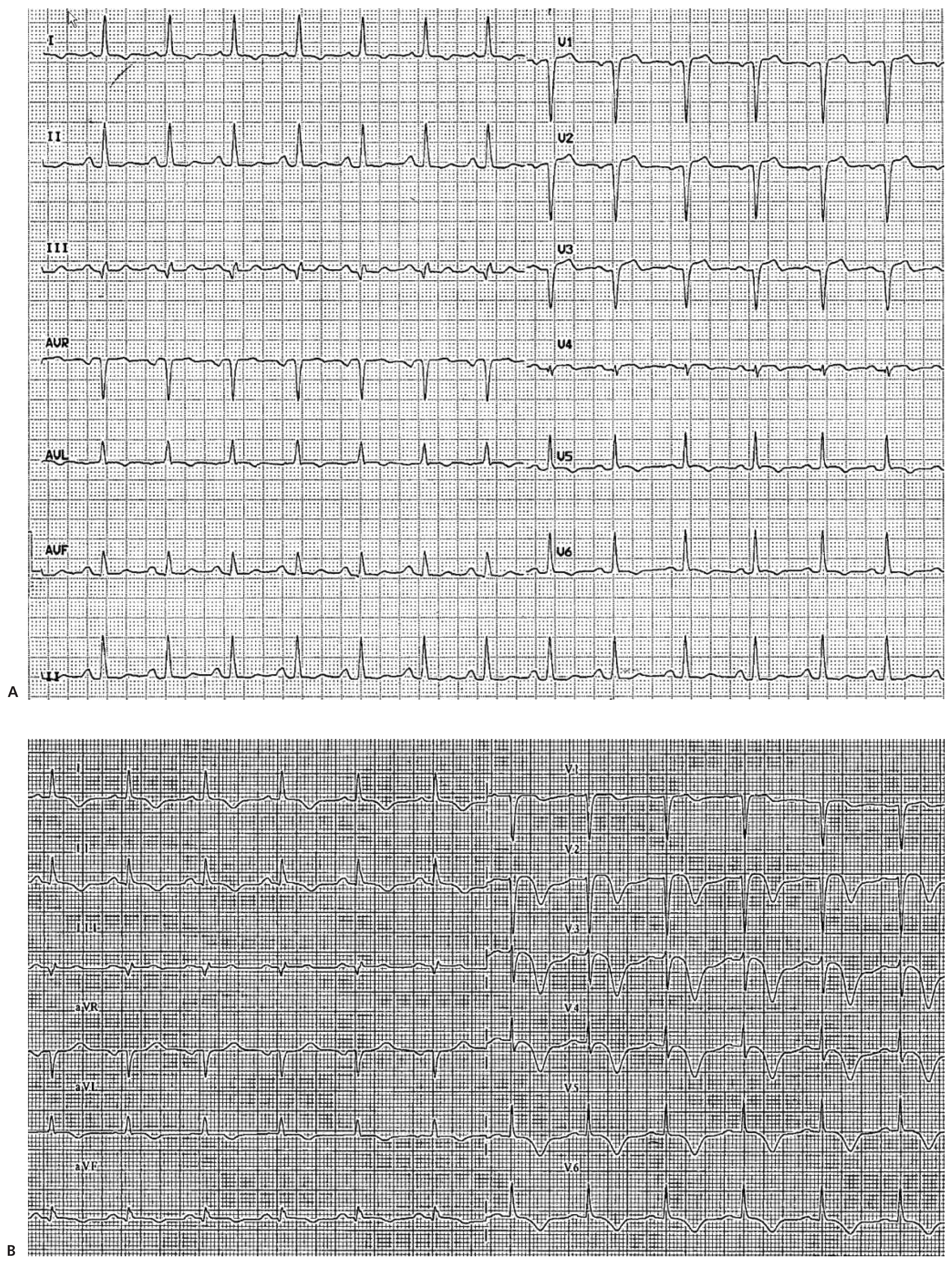 Cardiovascmed 15 00325 g001