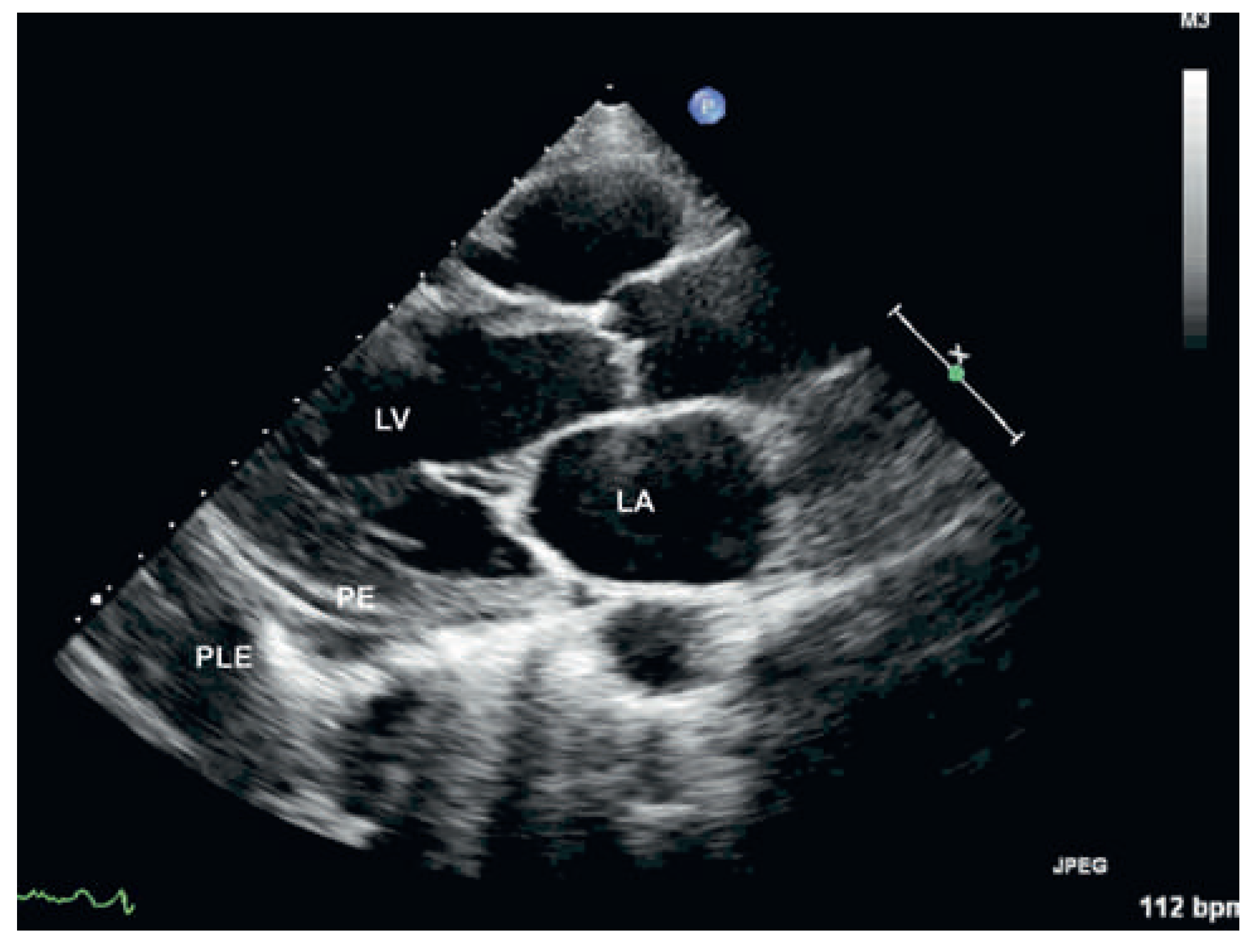 Cardiovascmed 15 00329 g001