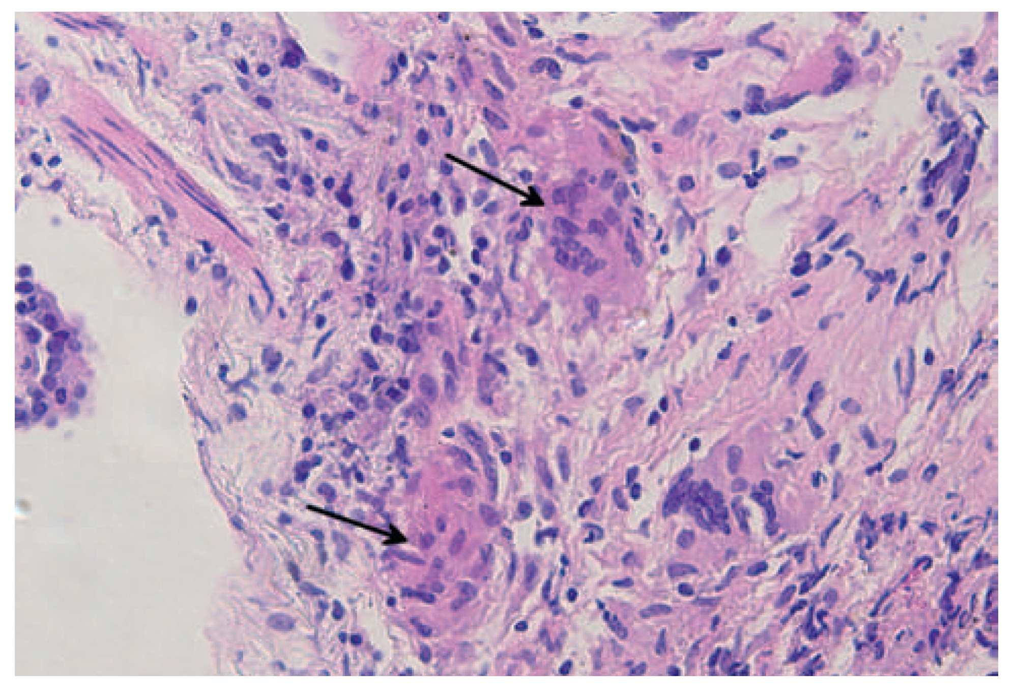 Cardiovascmed 15 00329 g003