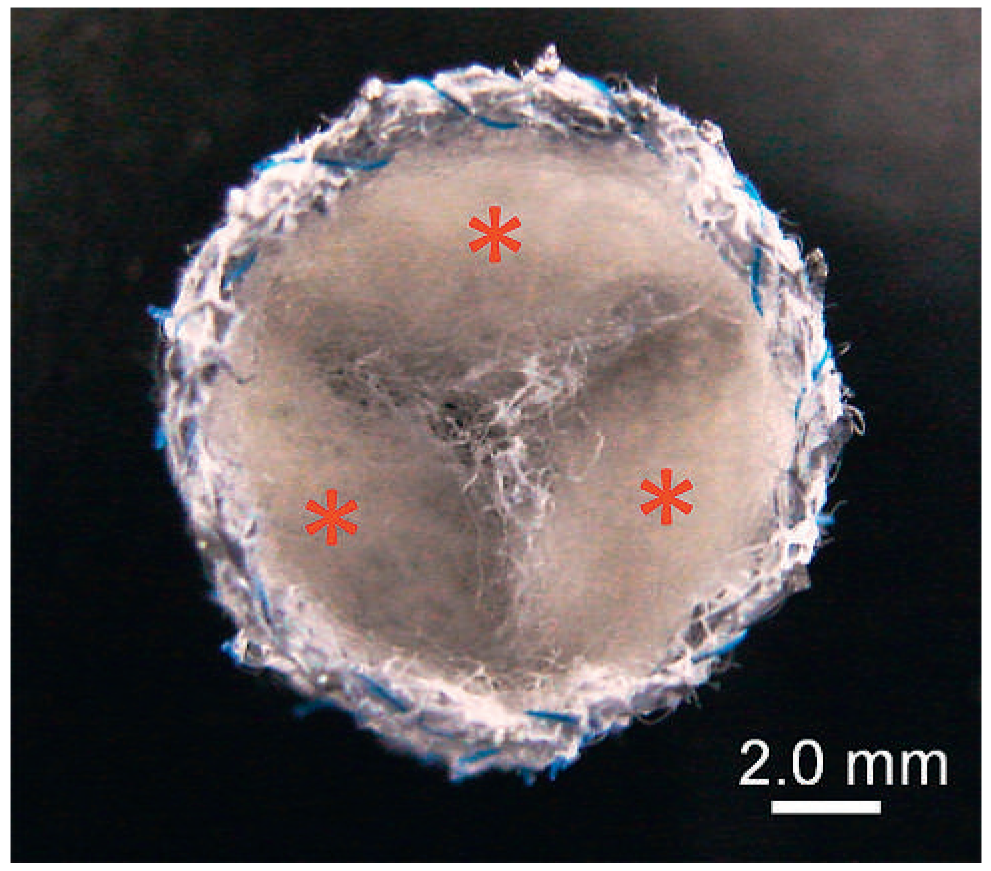 Cardiovascmed 15 00339 g002 Cardiovascmed 15 00339 g002