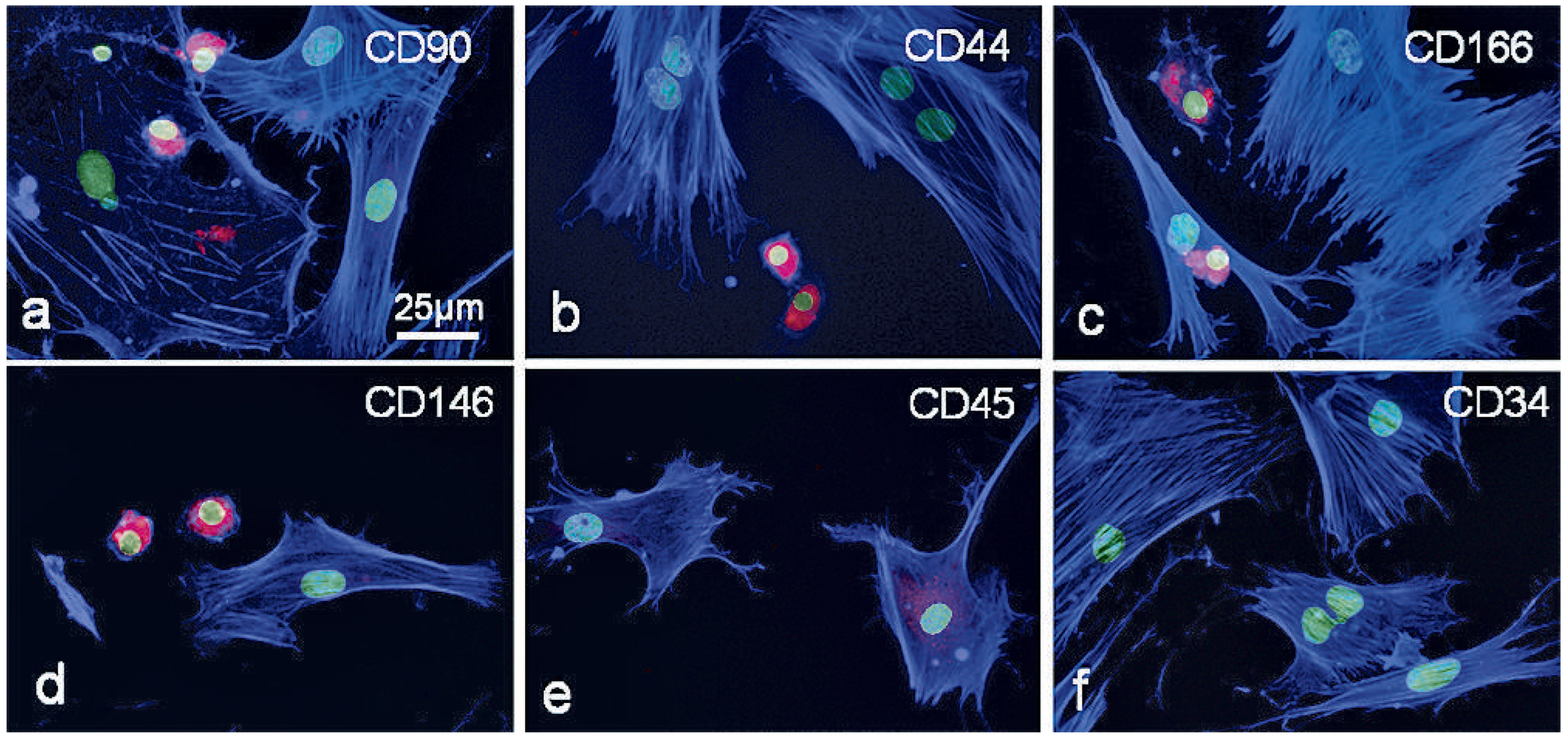 Cardiovascmed 15 00339 g003 Cardiovascmed 15 00339 g003