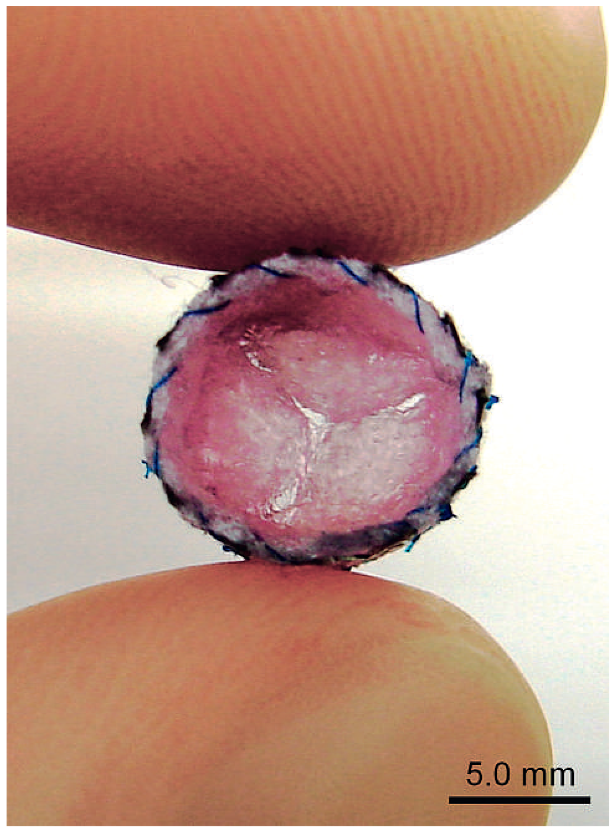 Cardiovascmed 15 00339 g005 Cardiovascmed 15 00339 g005