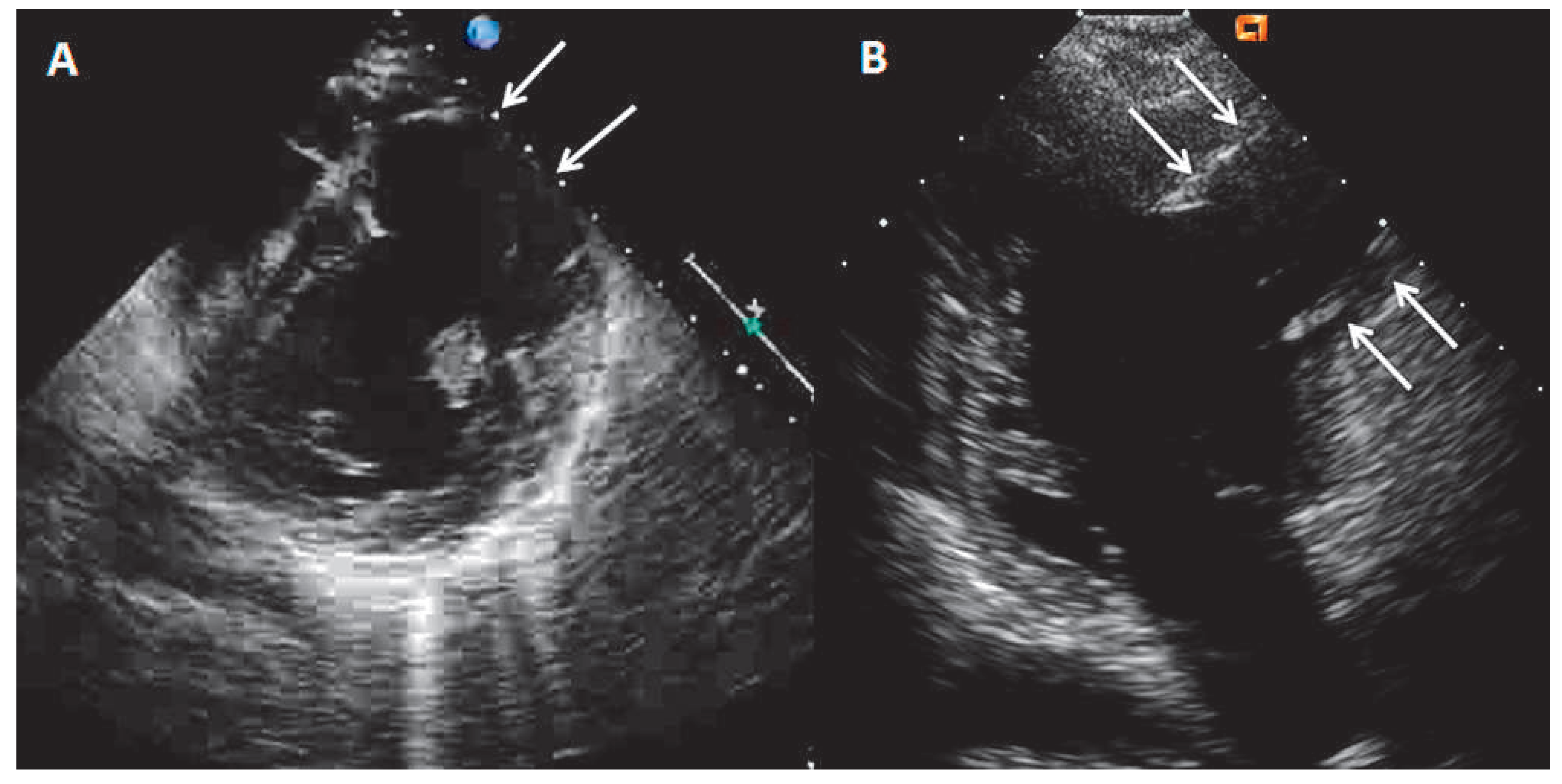 Cardiovascmed 15 00368 g001