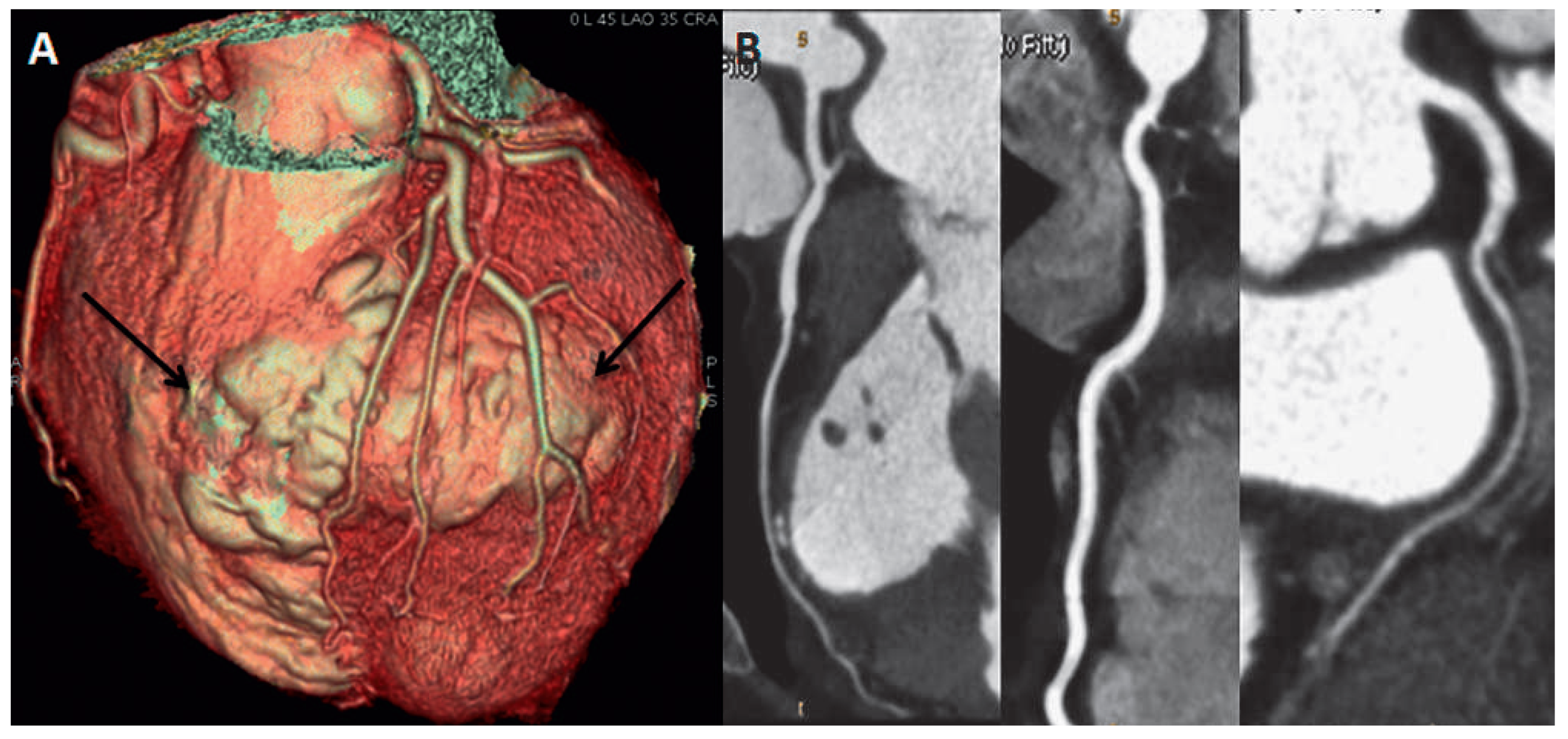 Cardiovascmed 15 00368 g003