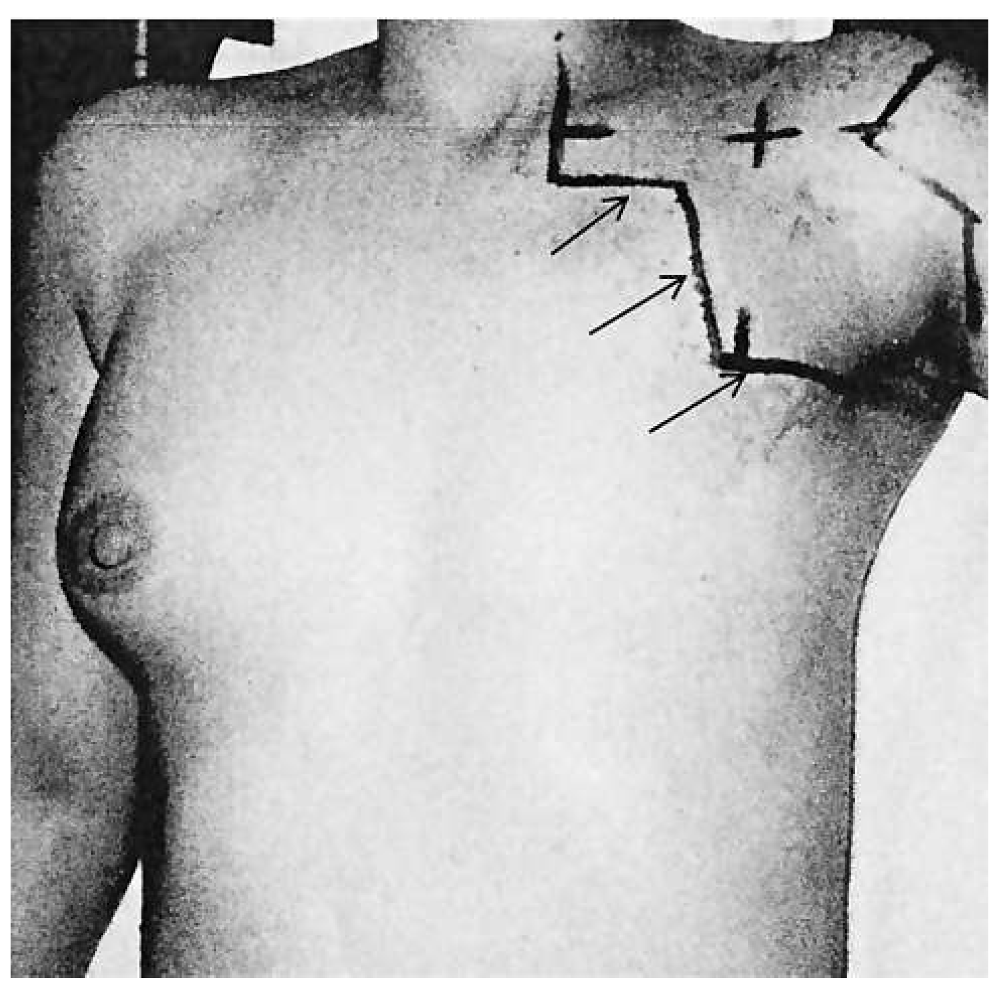 Cardiovascmed 15 00368 g004