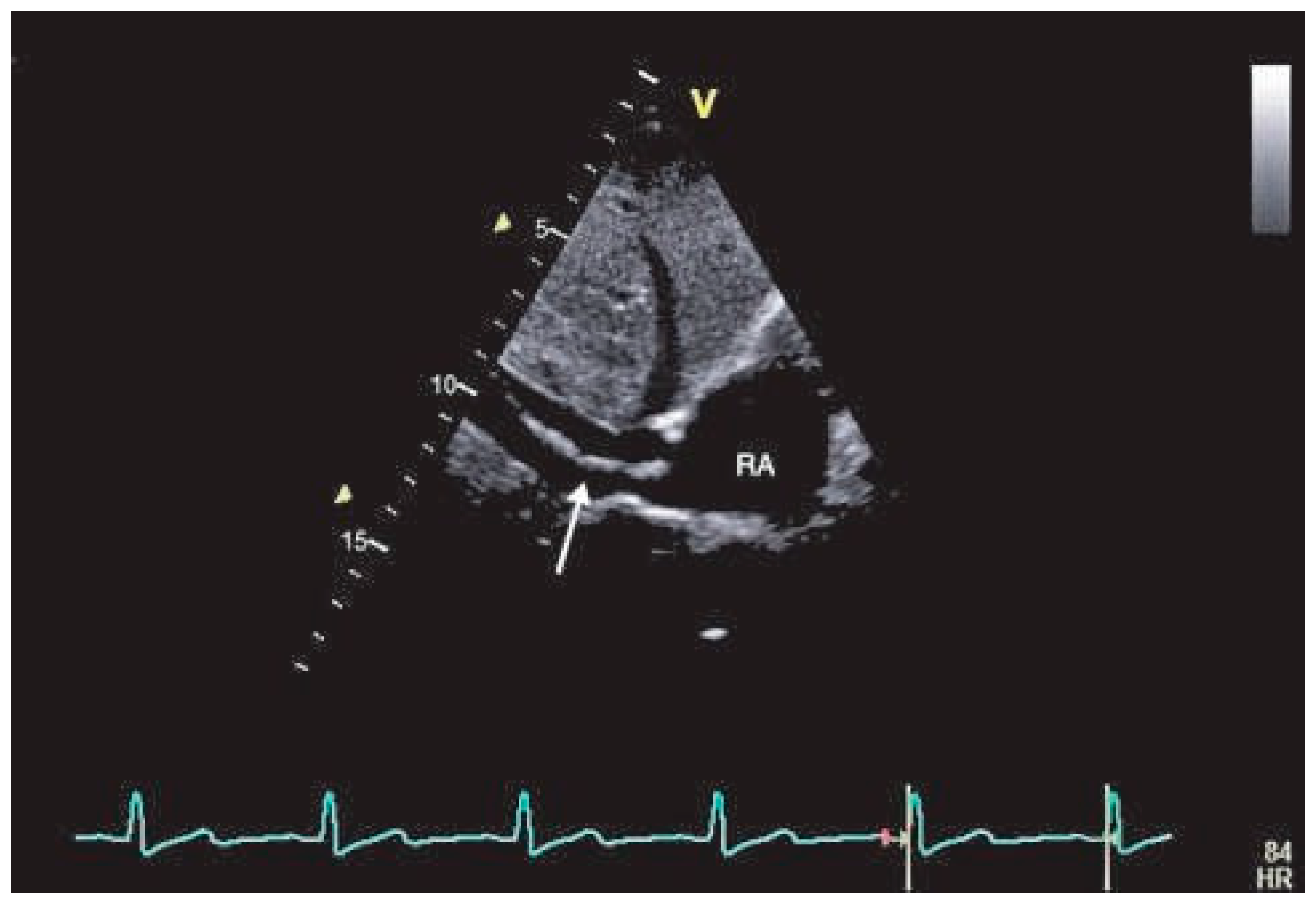 Cardiovascmed 16 00095 g001 Cardiovascmed 16 00095 g001