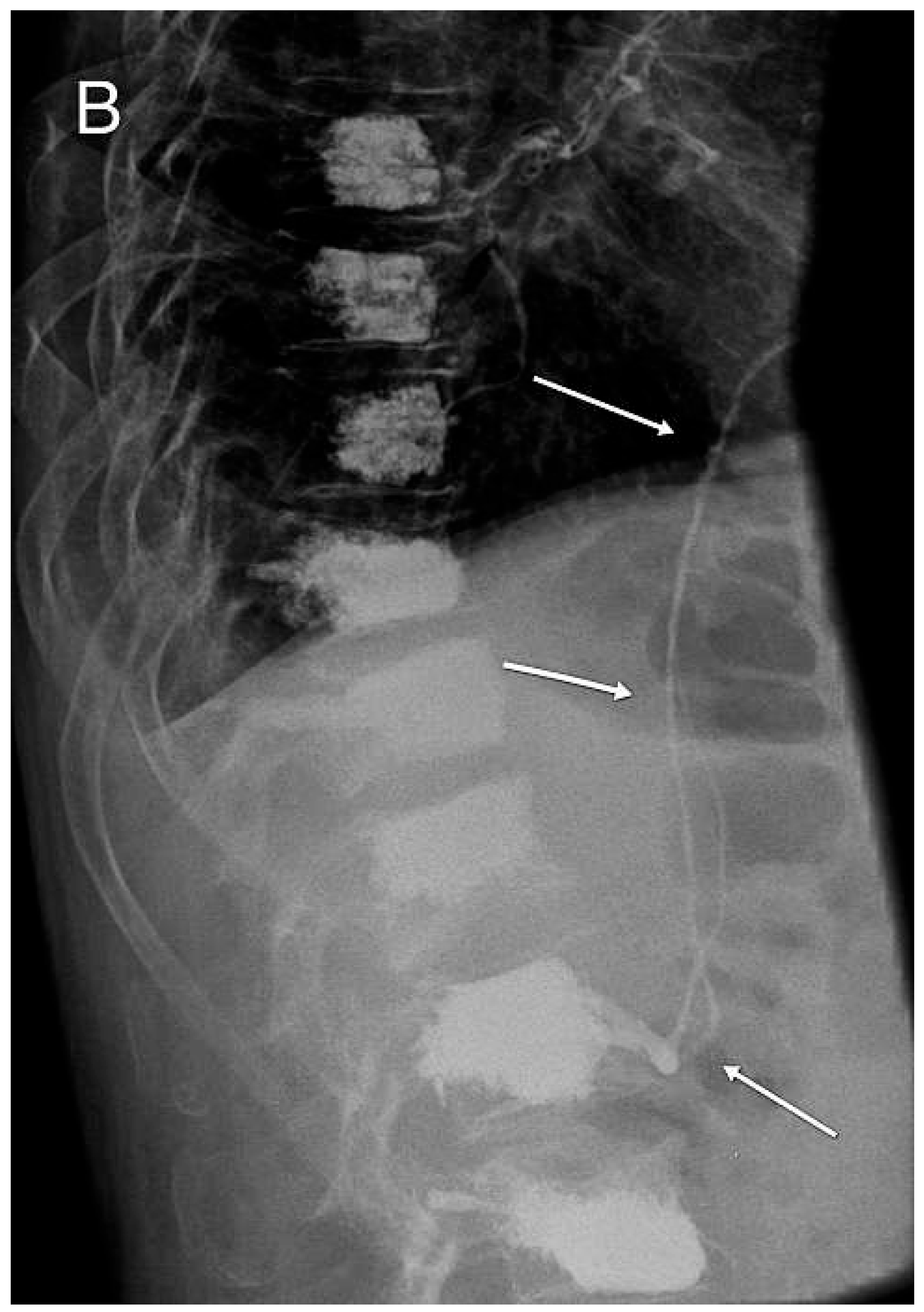 Cardiovascmed 16 00095 g003 Cardiovascmed 16 00095 g003