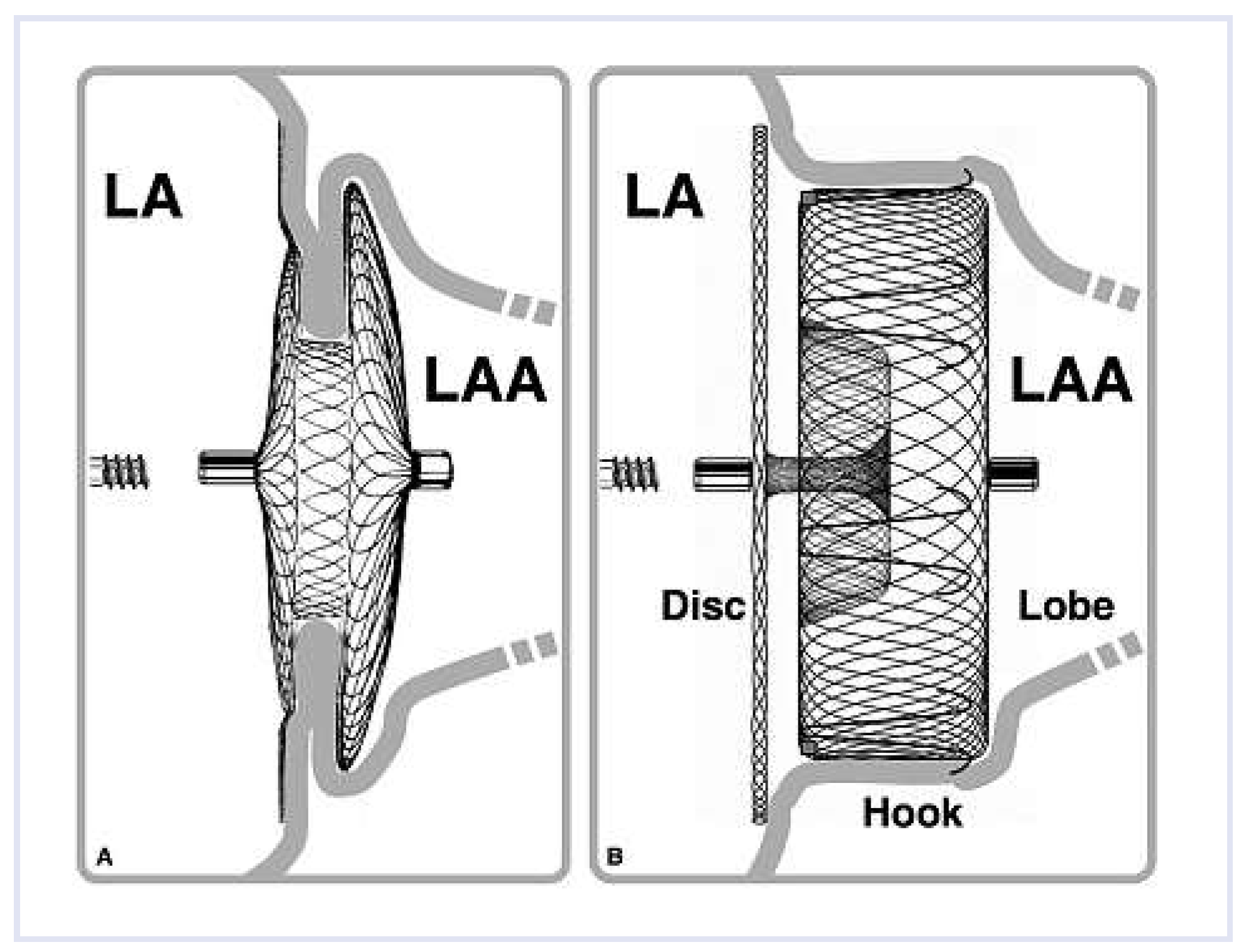 Cardiovascmed 16 00123 g001 Cardiovascmed 16 00123 g001
