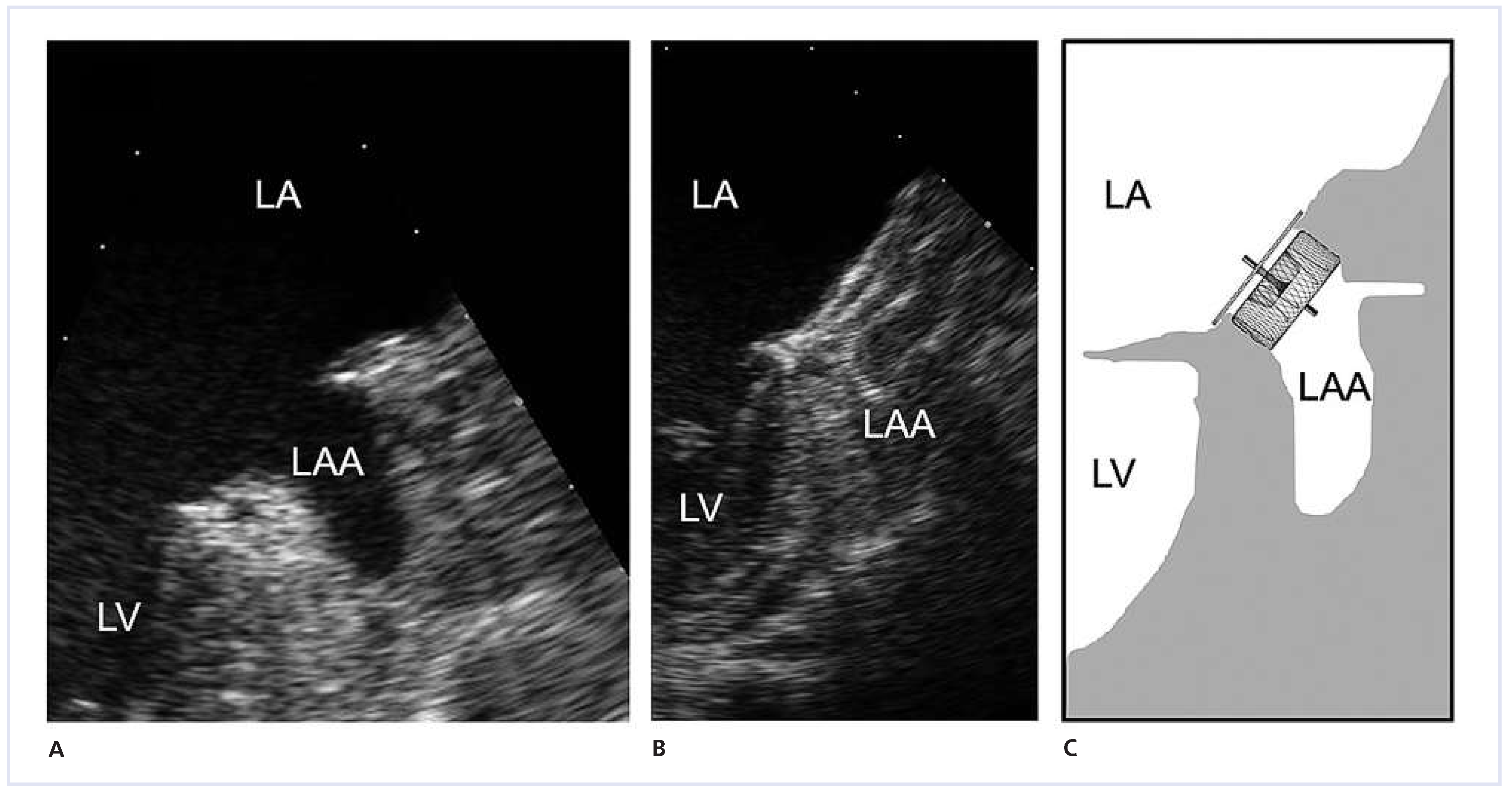 Cardiovascmed 16 00123 g002 Cardiovascmed 16 00123 g002
