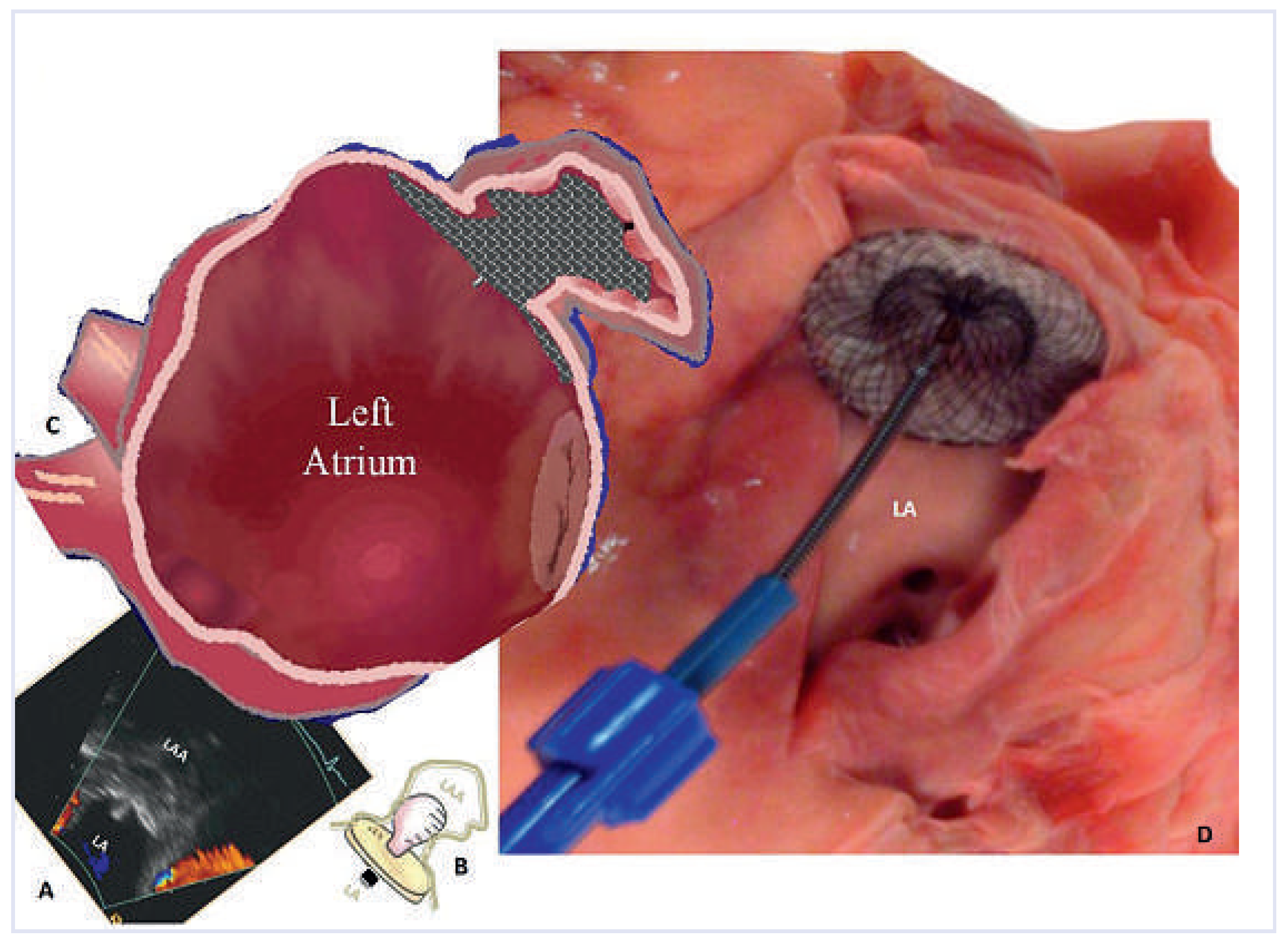 Cardiovascmed 16 00123 g003 Cardiovascmed 16 00123 g003