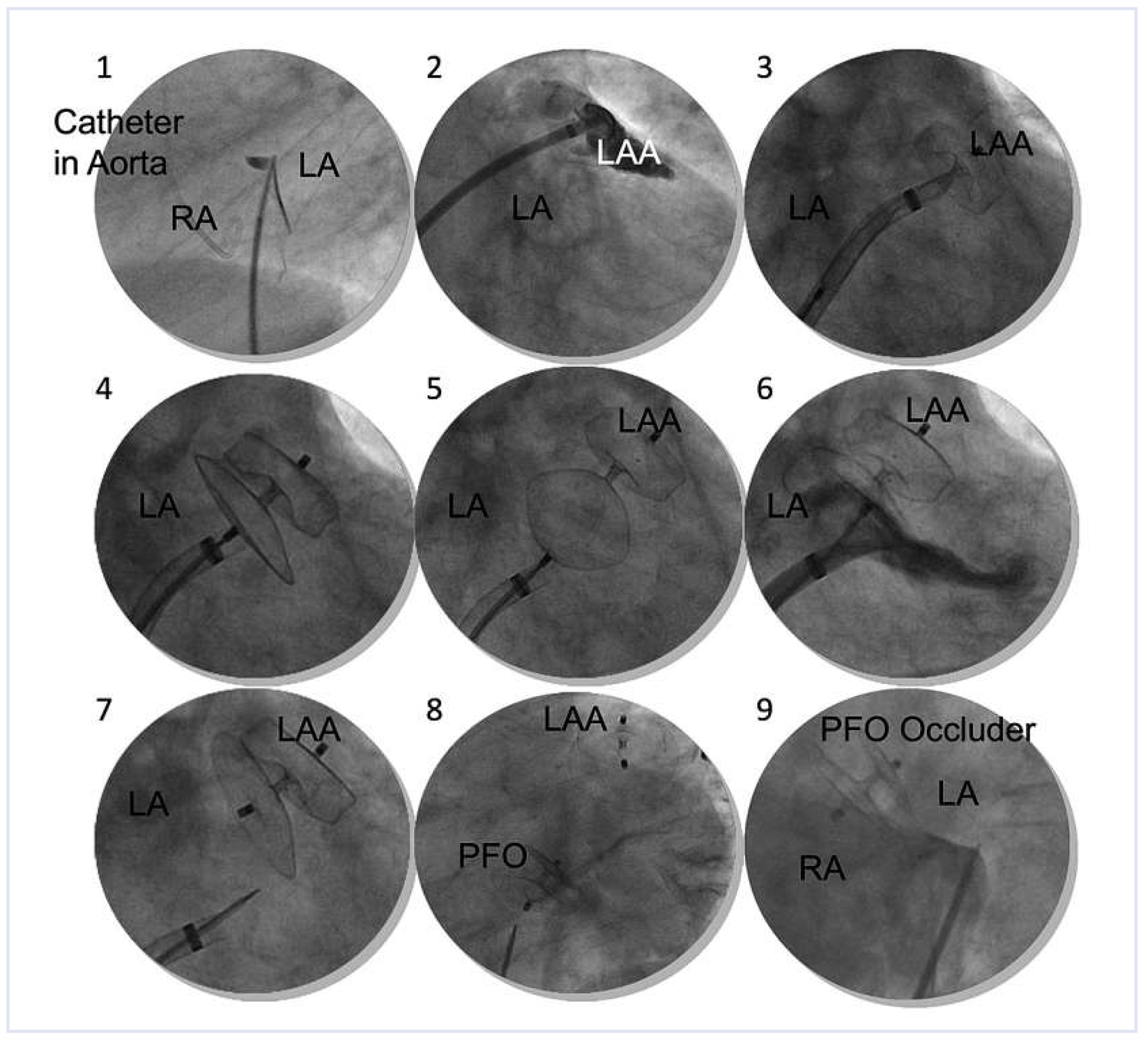 Cardiovascmed 16 00123 g004 Cardiovascmed 16 00123 g004