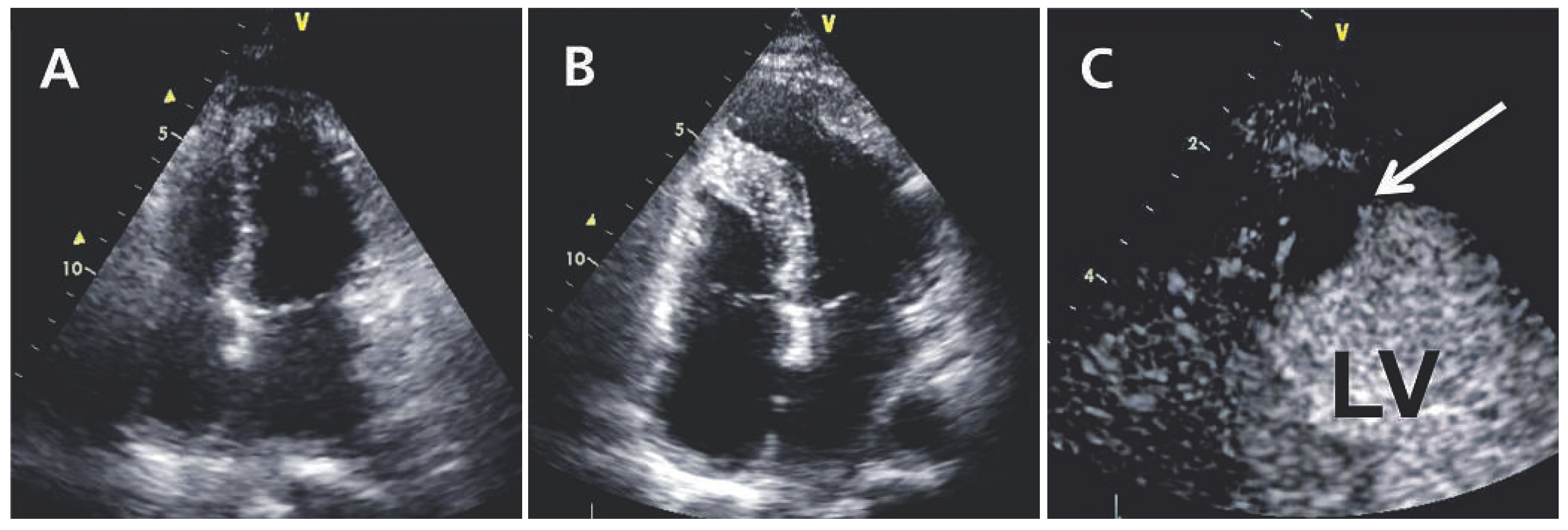 Cardiovascmed 16 00132 g001 Cardiovascmed 16 00132 g001