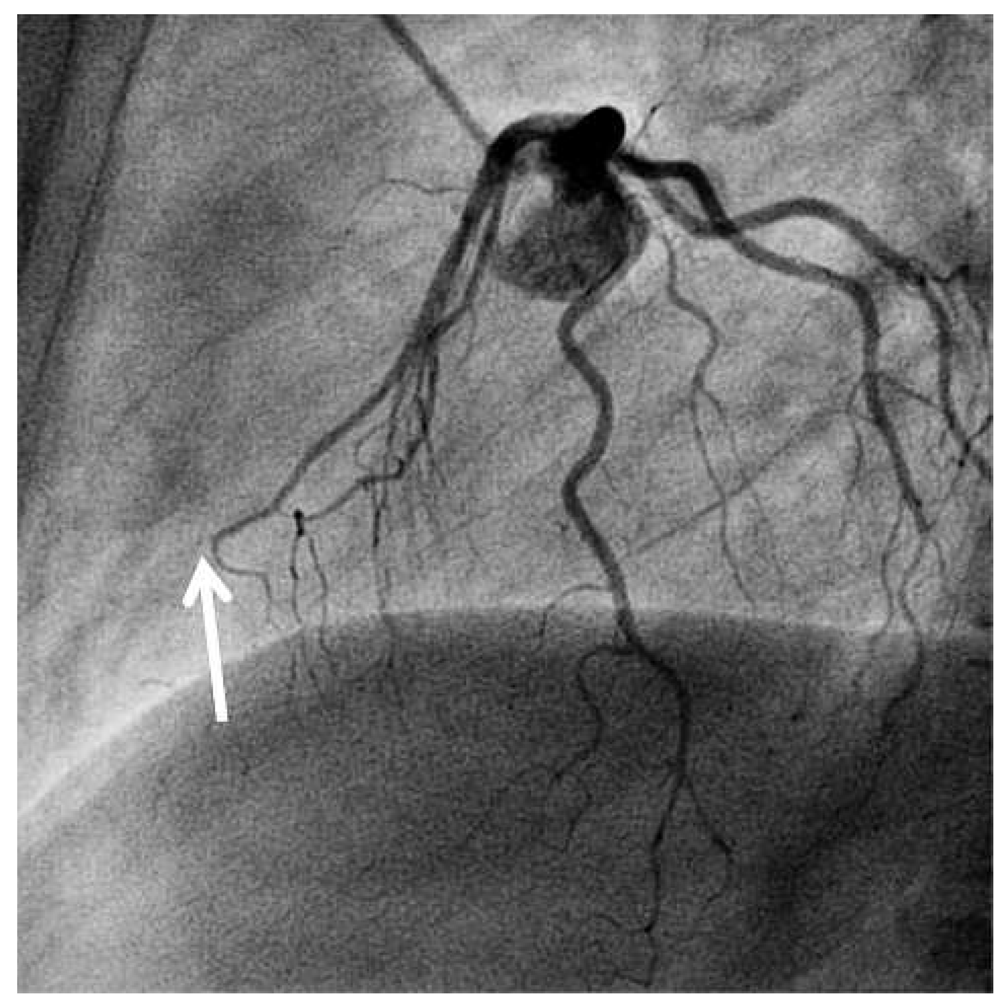 Cardiovascmed 16 00132 g002 Cardiovascmed 16 00132 g002