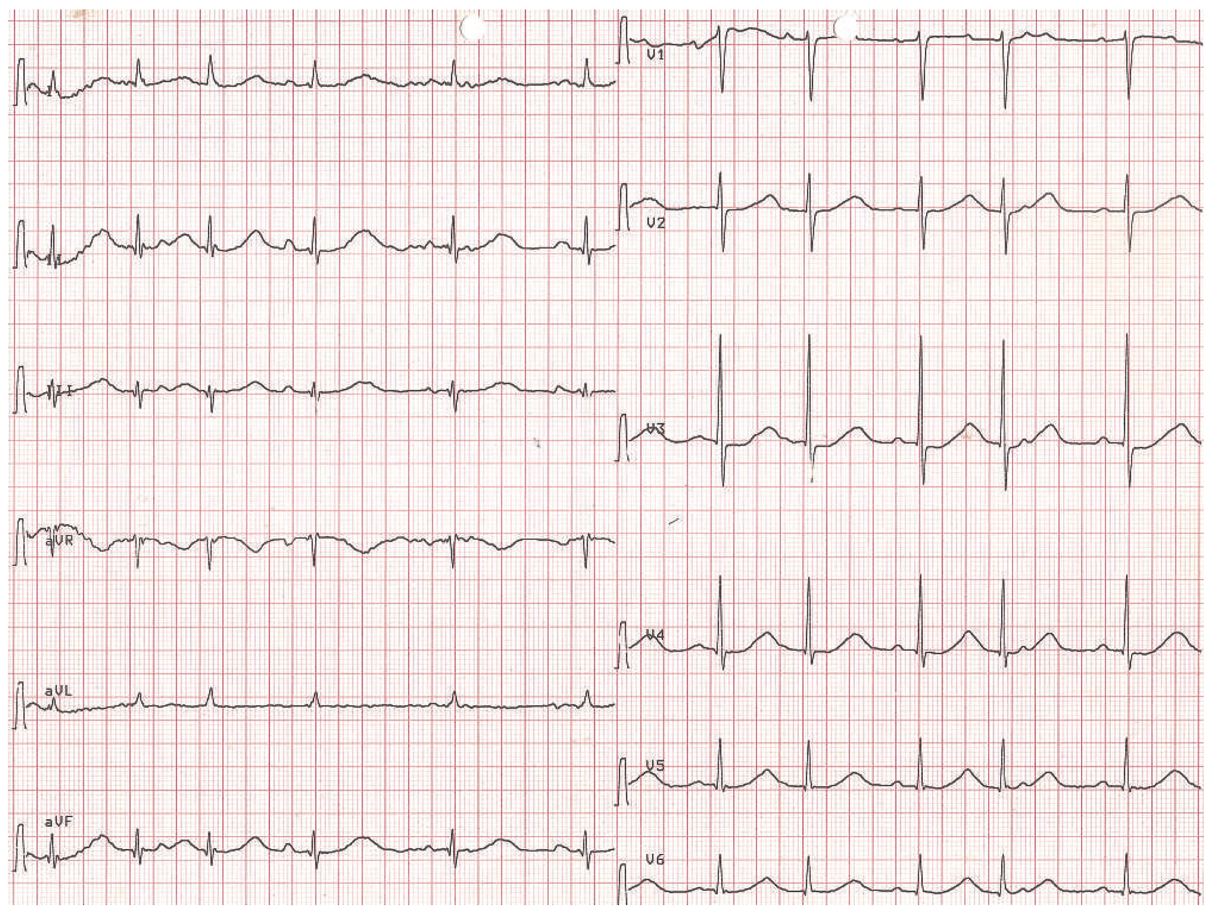 Cardiovascmed 16 00134 g001