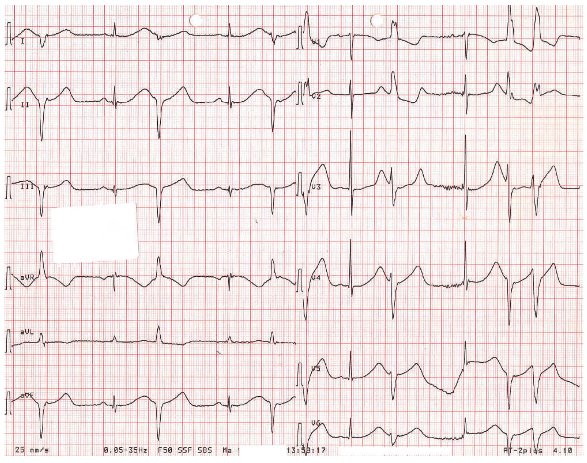 Cardiovascmed 16 00134 g002