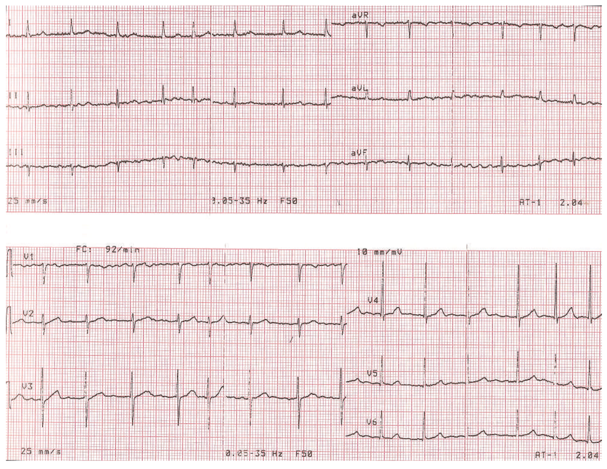 Cardiovascmed 16 00134 g003