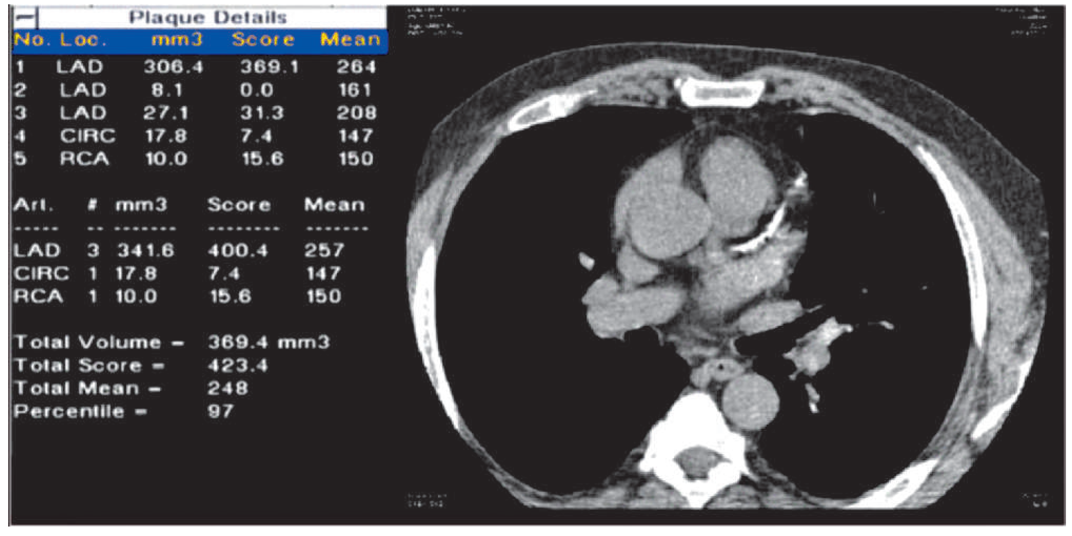 Cardiovascmed 16 00144 g001