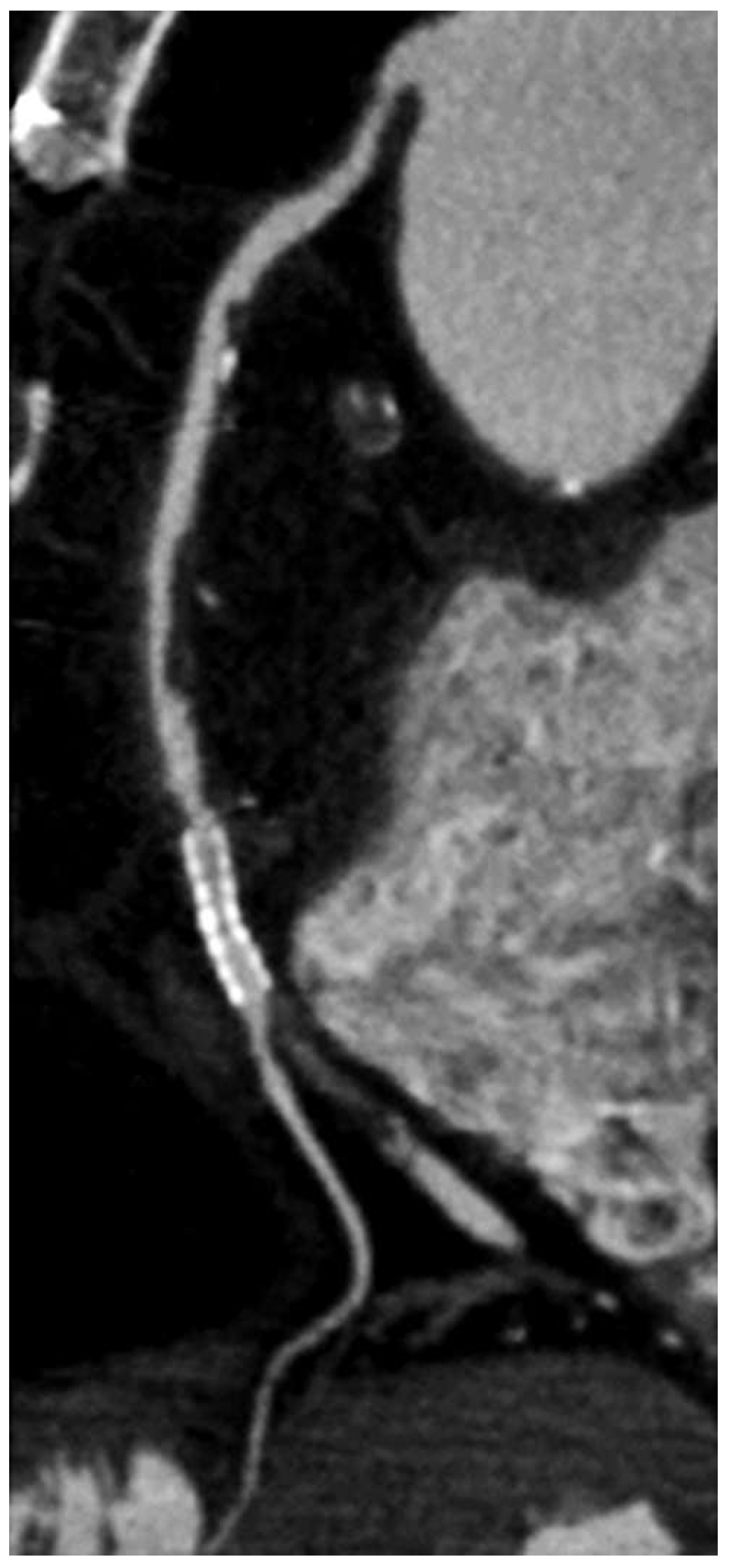 Cardiovascmed 16 00144 g002