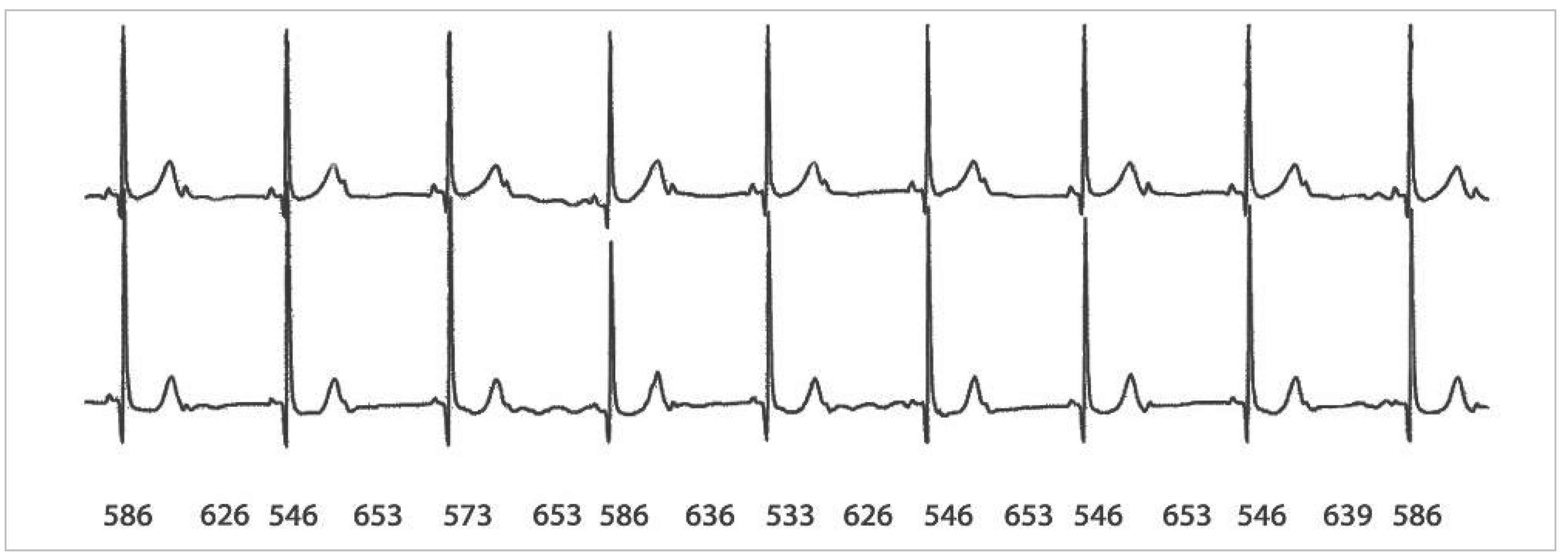 Cardiovascmed 16 00160 g001 Cardiovascmed 16 00160 g001