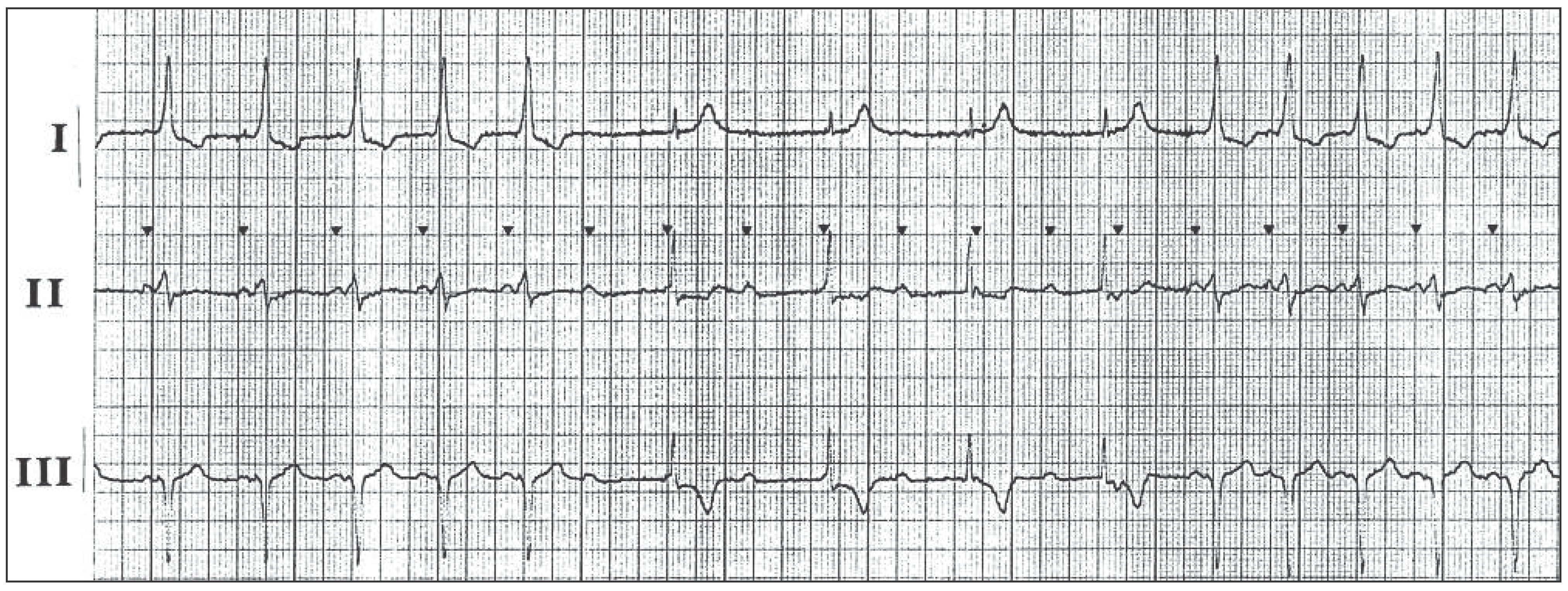 Cardiovascmed 16 00186 g001