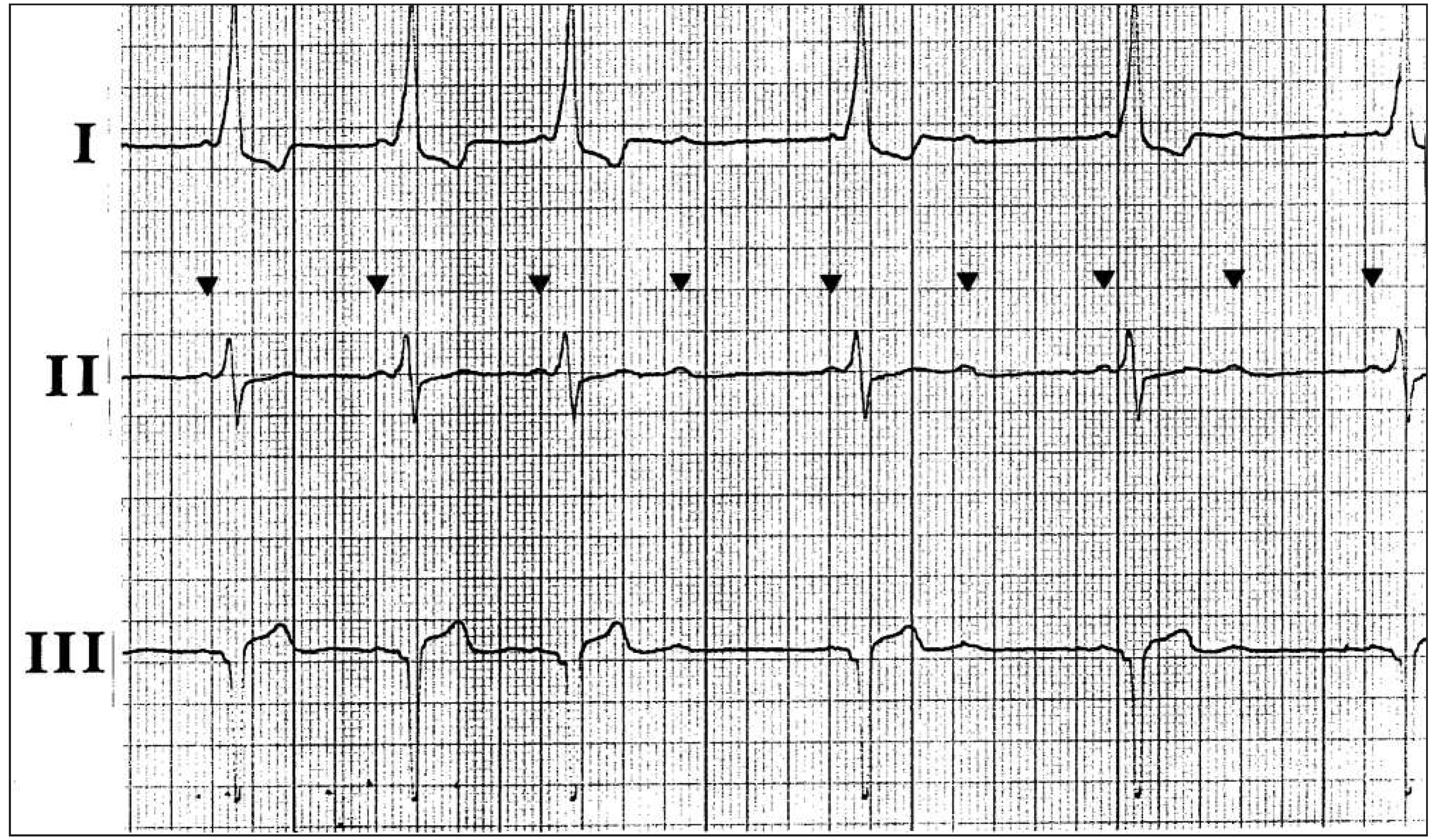 Cardiovascmed 16 00186 g002
