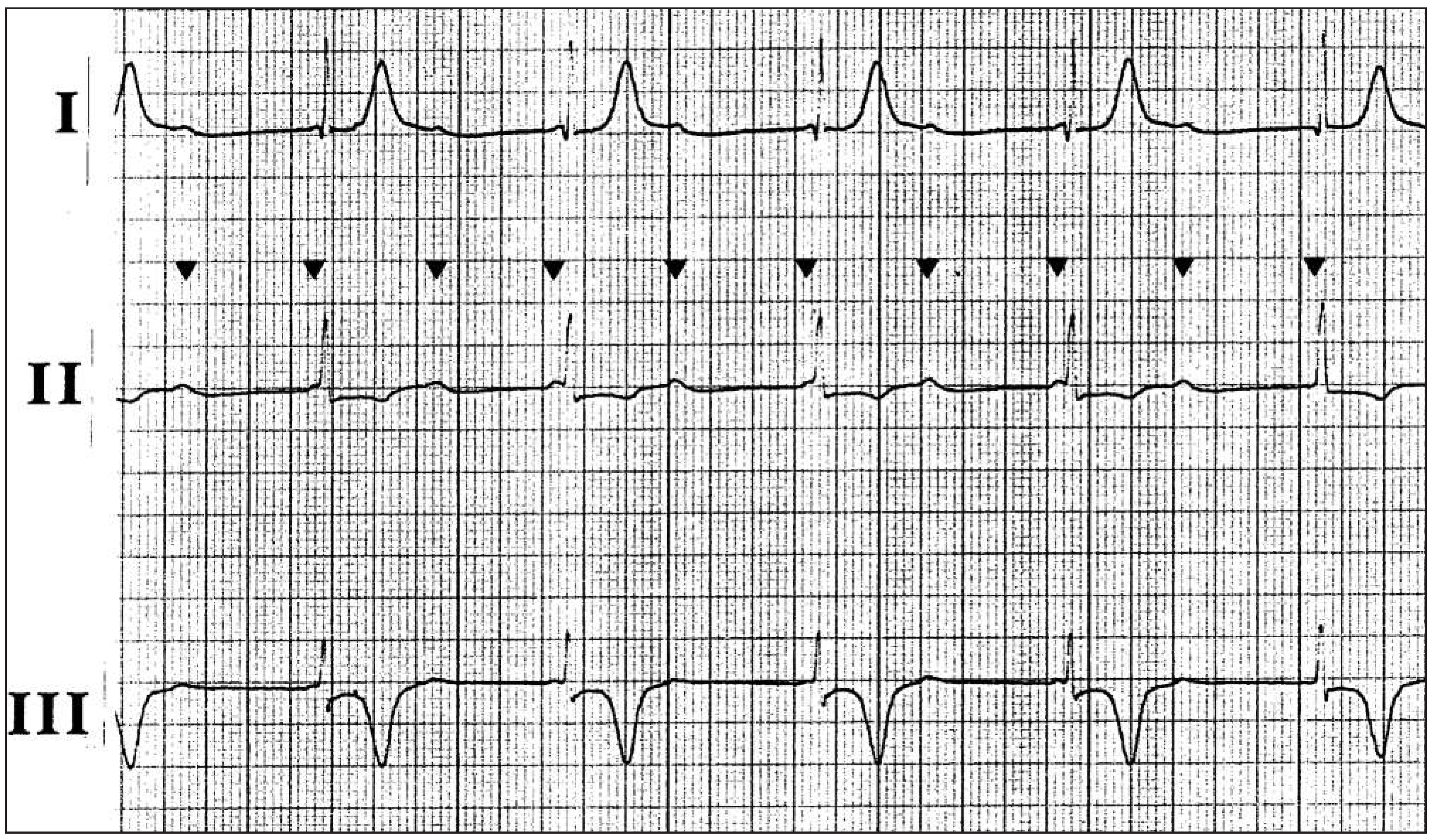 Cardiovascmed 16 00186 g003