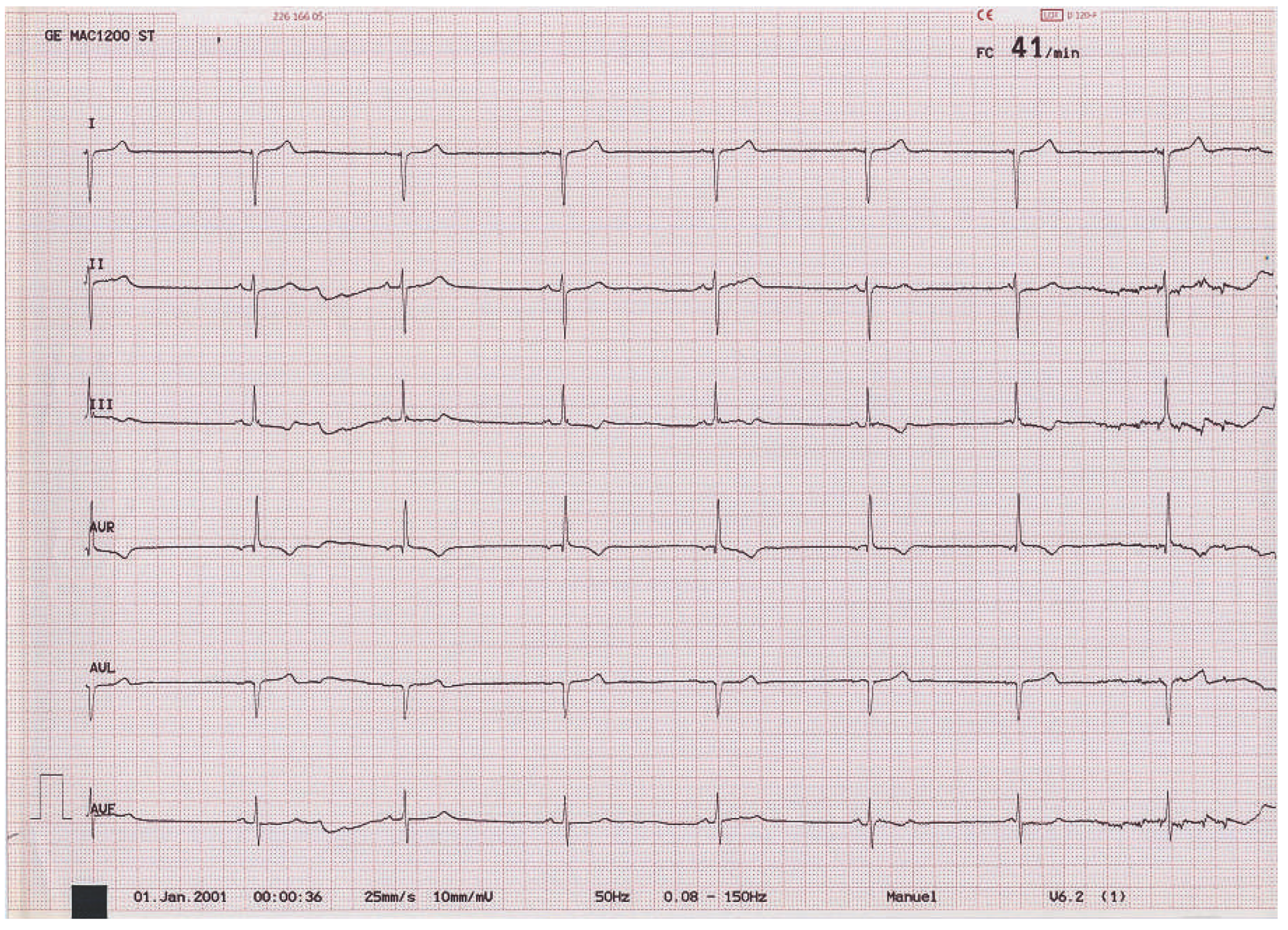 Cardiovascmed 16 00189 g001