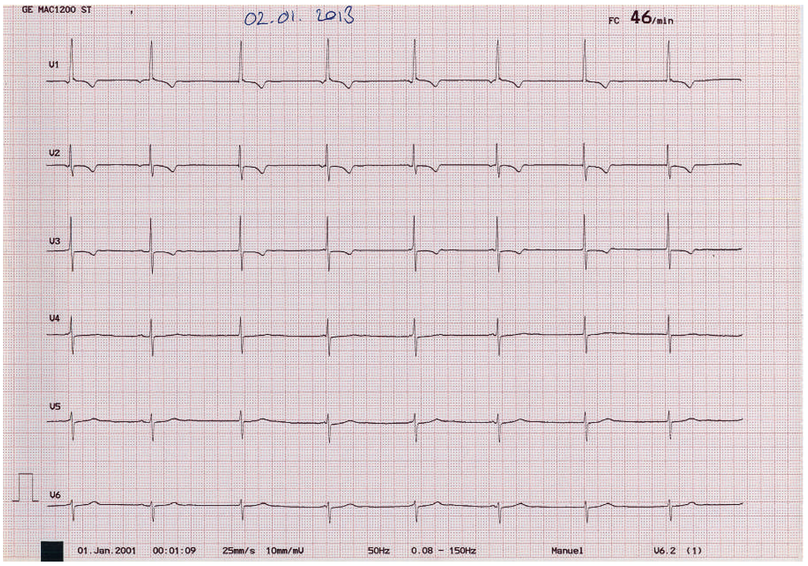 Cardiovascmed 16 00189 g002