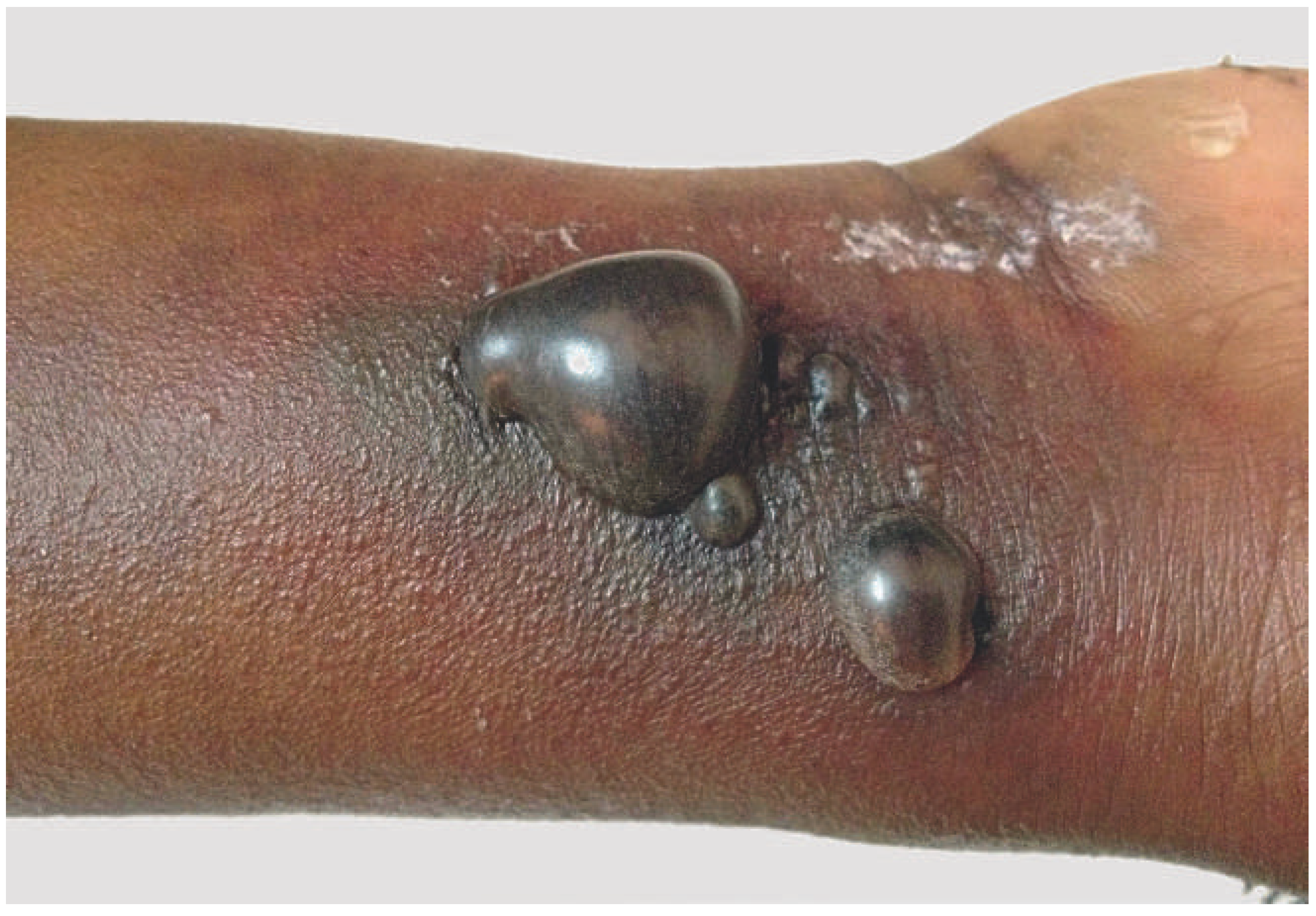 Cardiovascmed 16 00191 g001