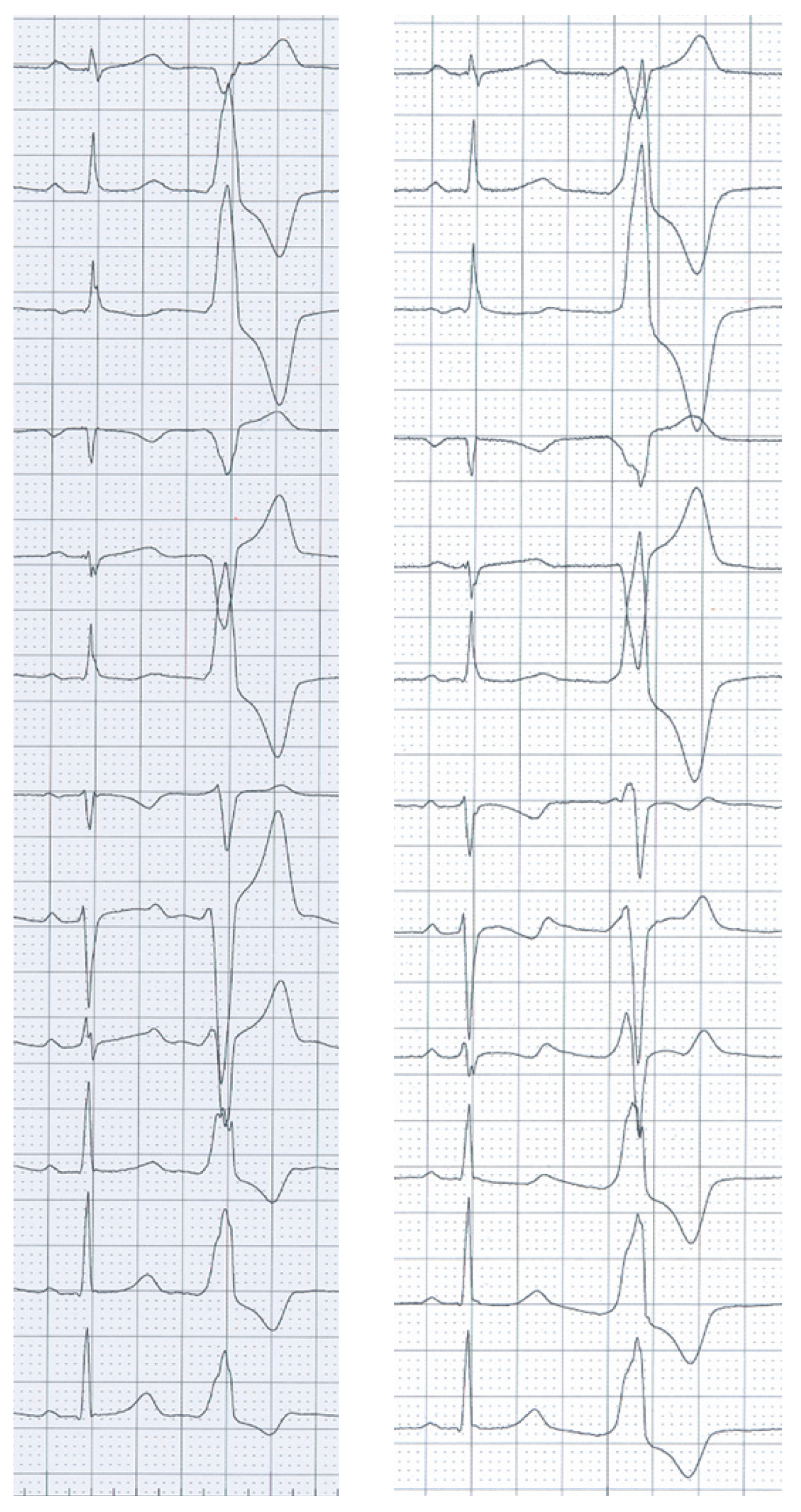 Cardiovascmed 16 00208 g001