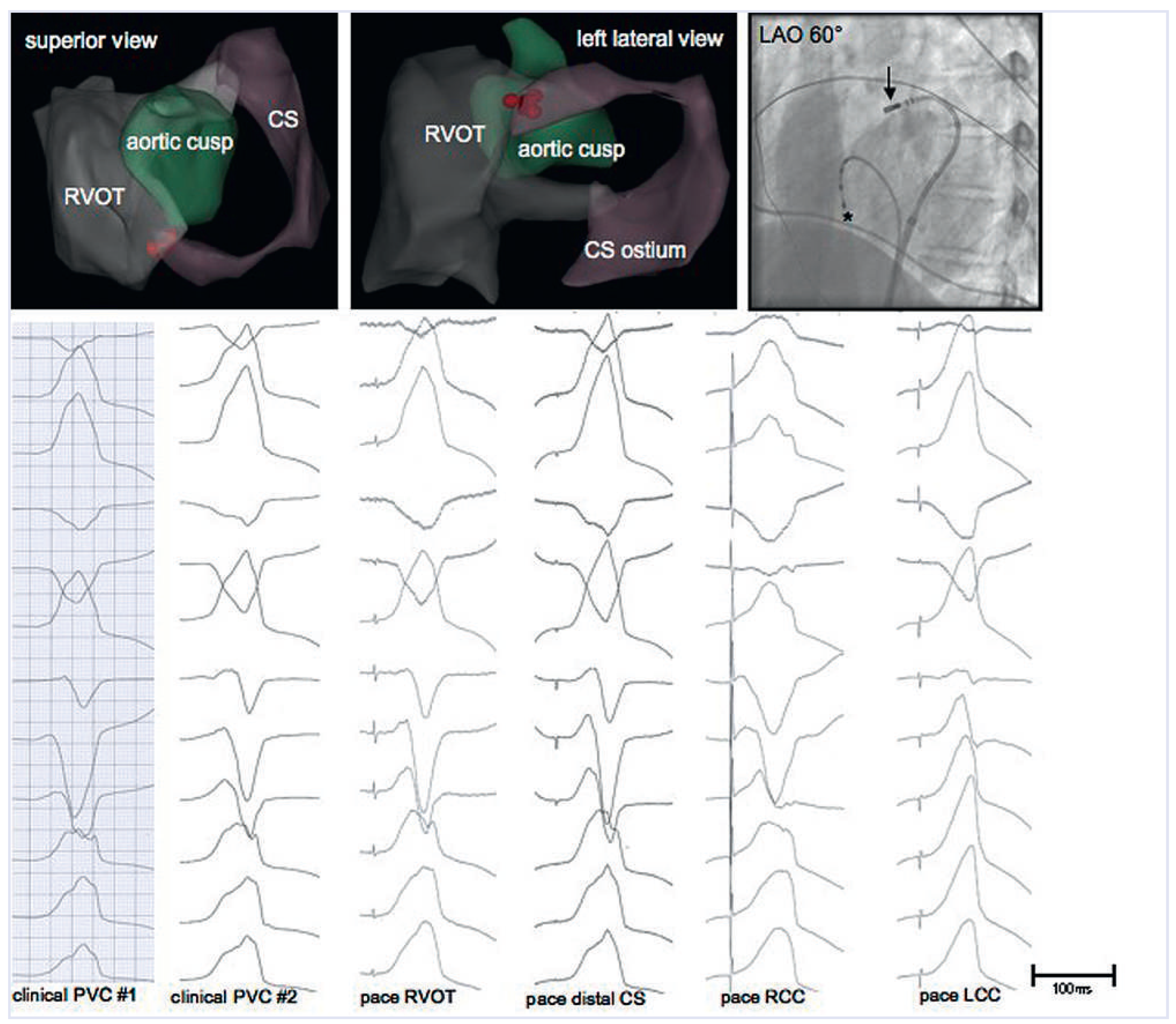 Cardiovascmed 16 00208 g002
