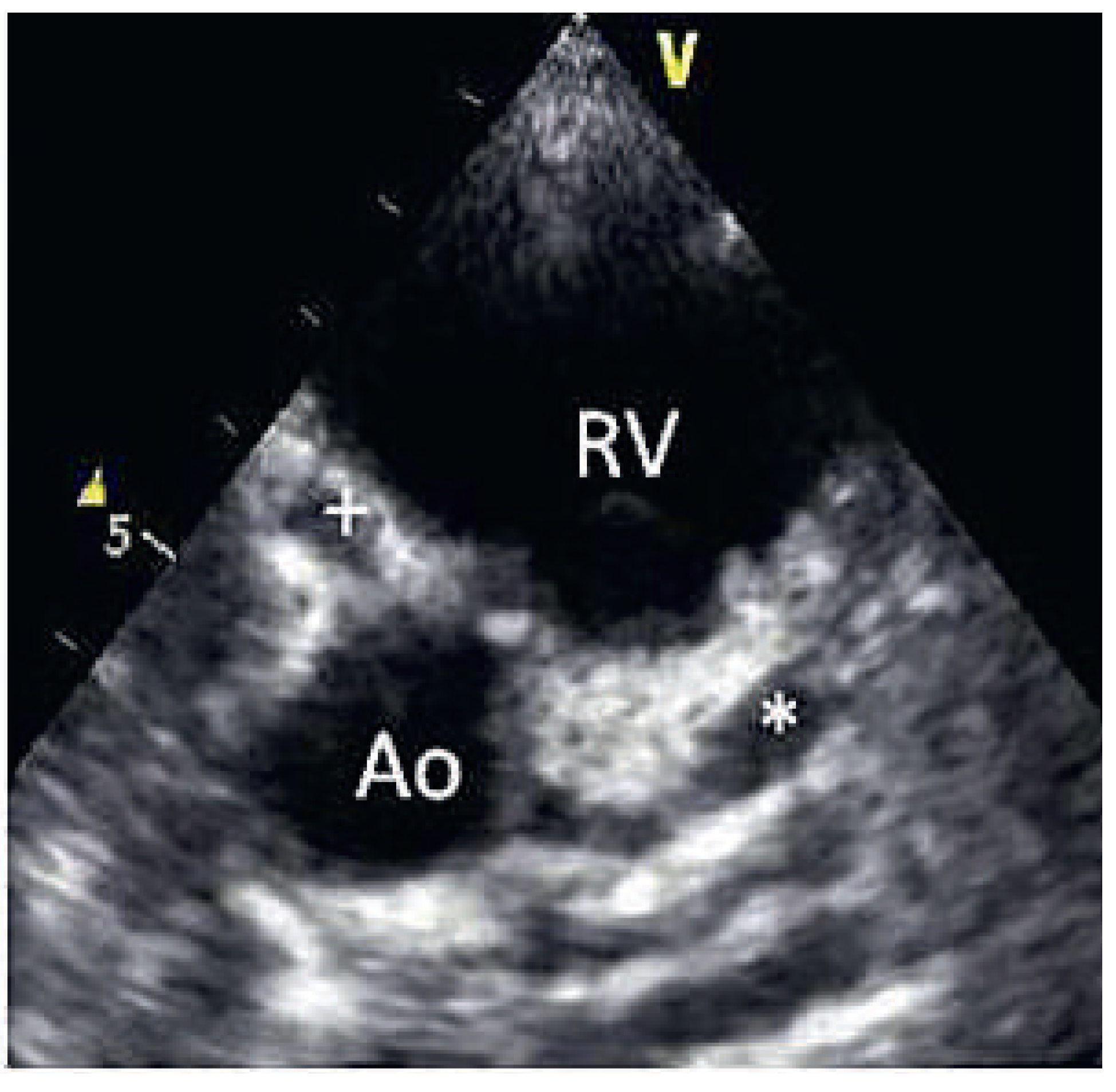 Cardiovascmed 16 00211 g002