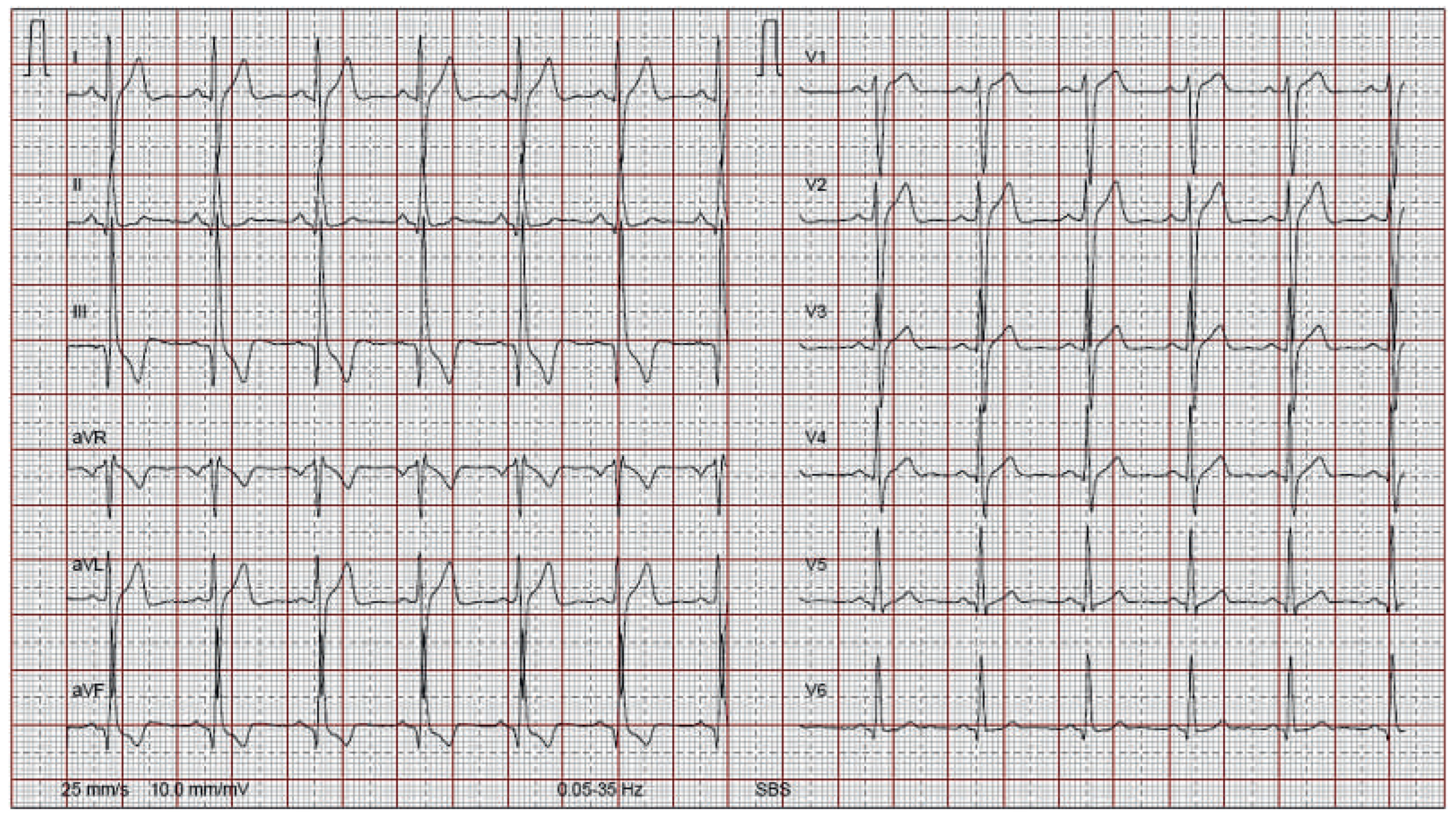 Cardiovascmed 16 00216 g001