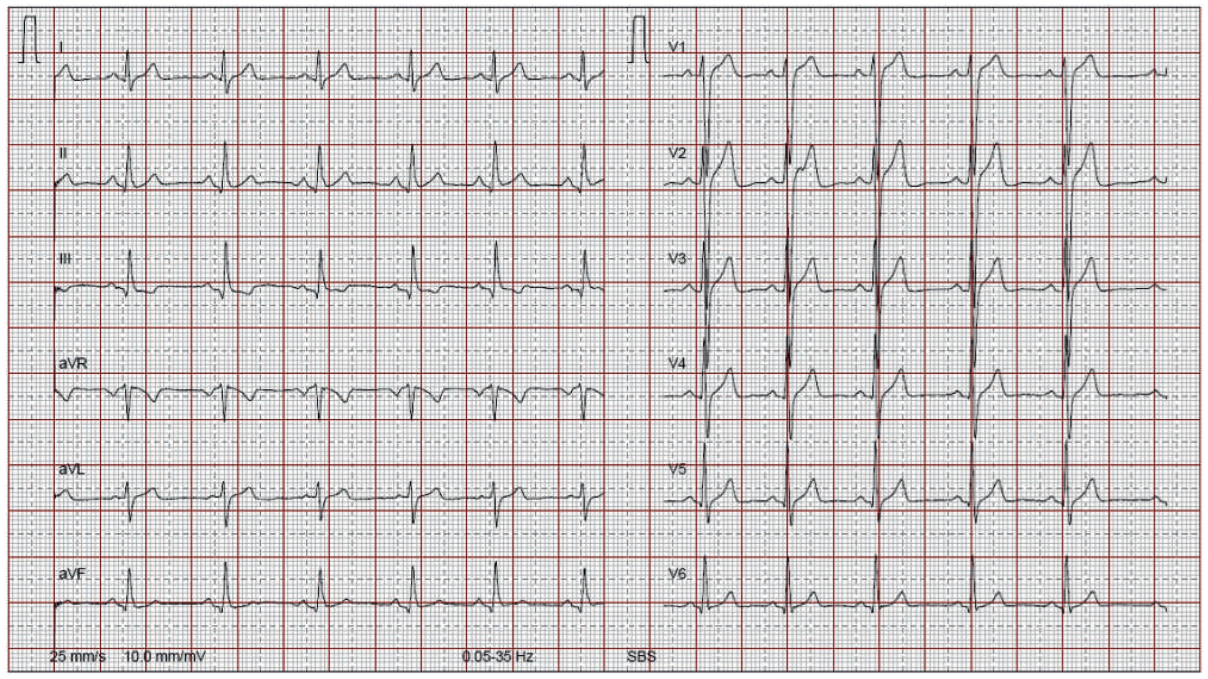 Cardiovascmed 16 00216 g002