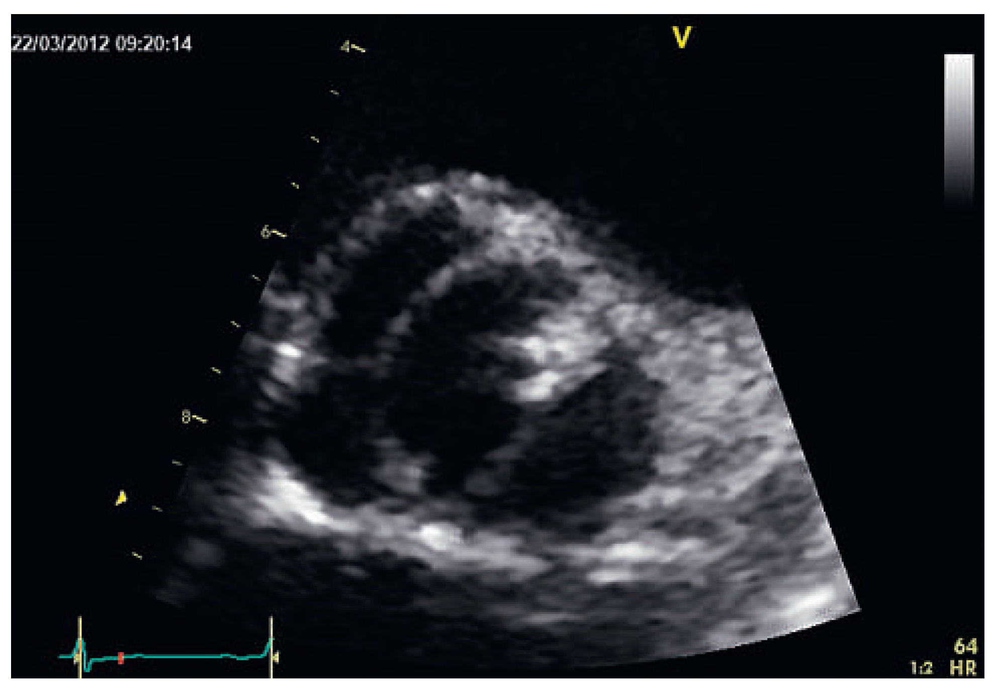 Cardiovascmed 16 00218 g002 Cardiovascmed 16 00218 g002