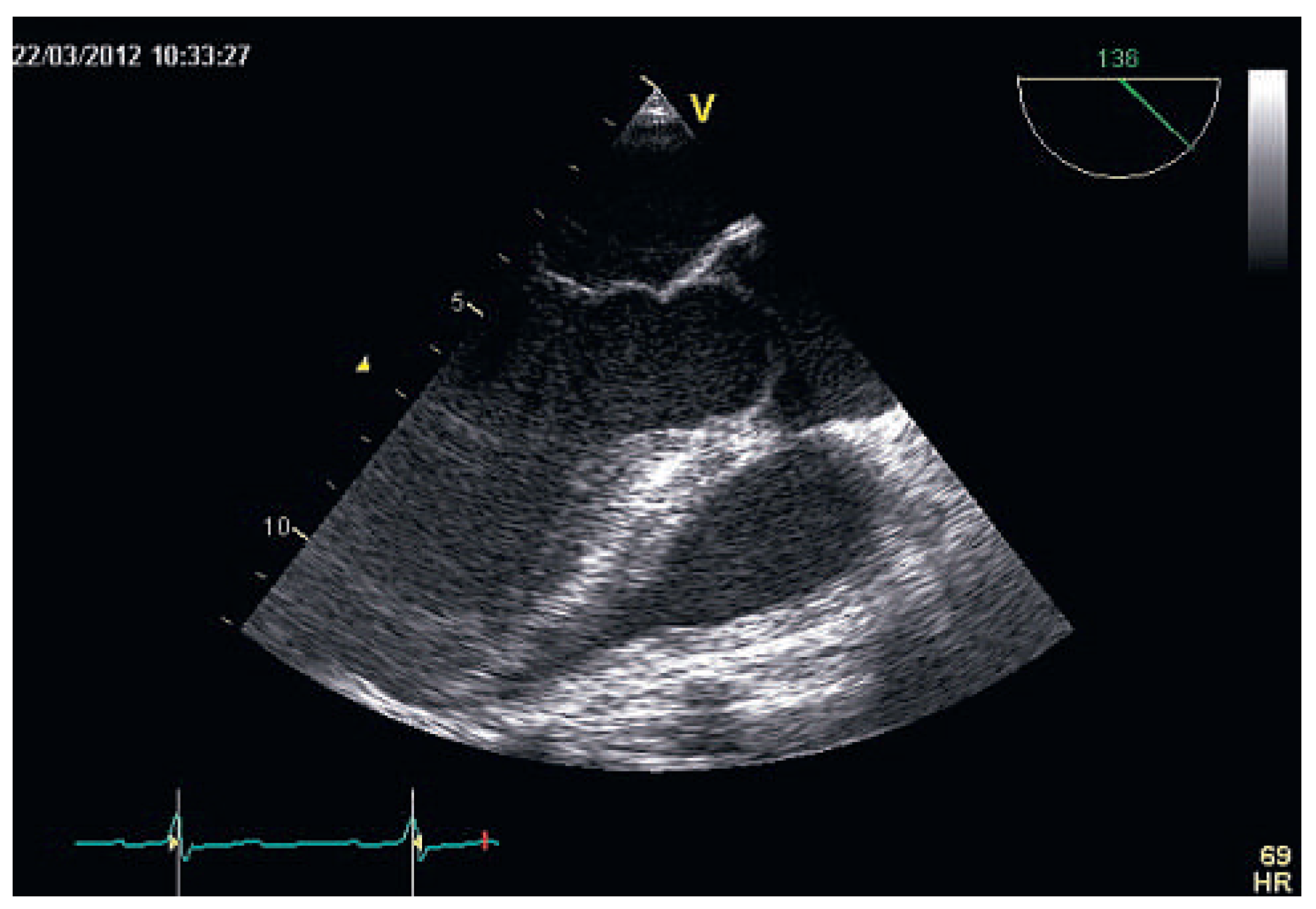 Cardiovascmed 16 00218 g003 Cardiovascmed 16 00218 g003