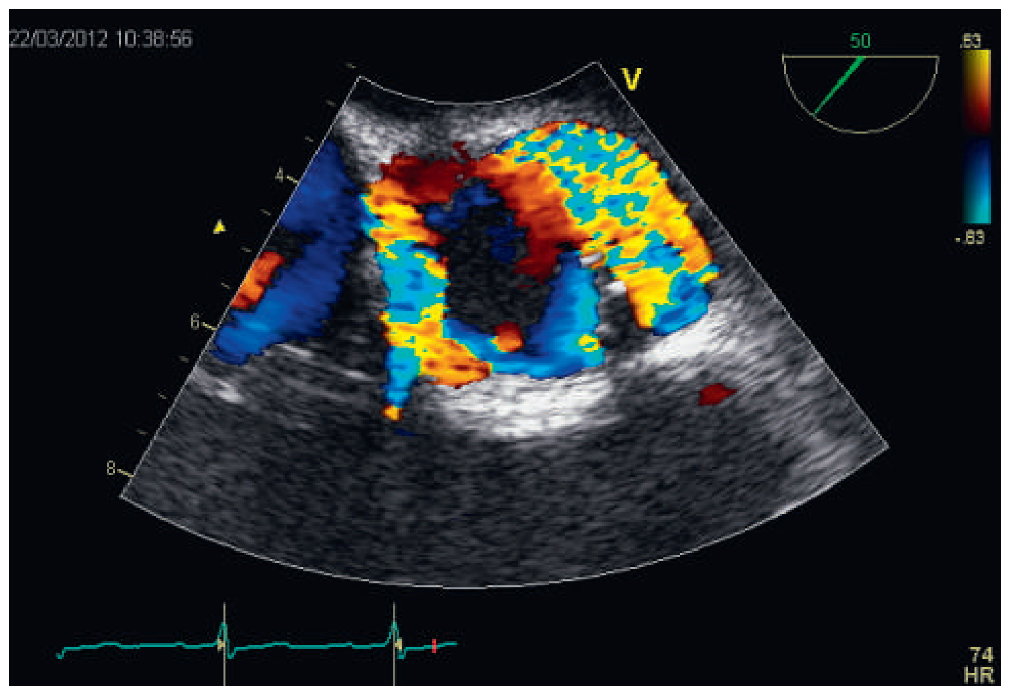 Cardiovascmed 16 00218 g004 Cardiovascmed 16 00218 g004