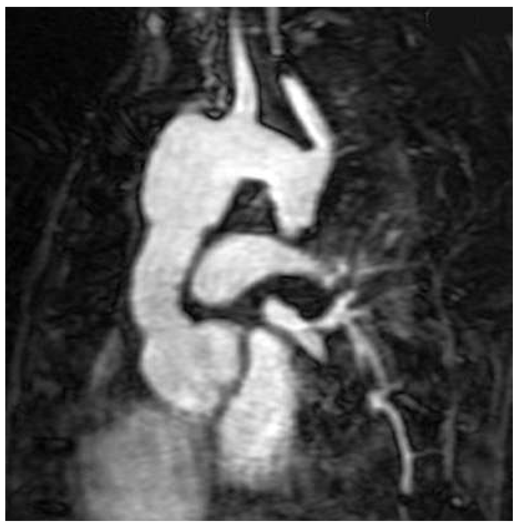 Cardiovascmed 16 00218 g006 Cardiovascmed 16 00218 g006