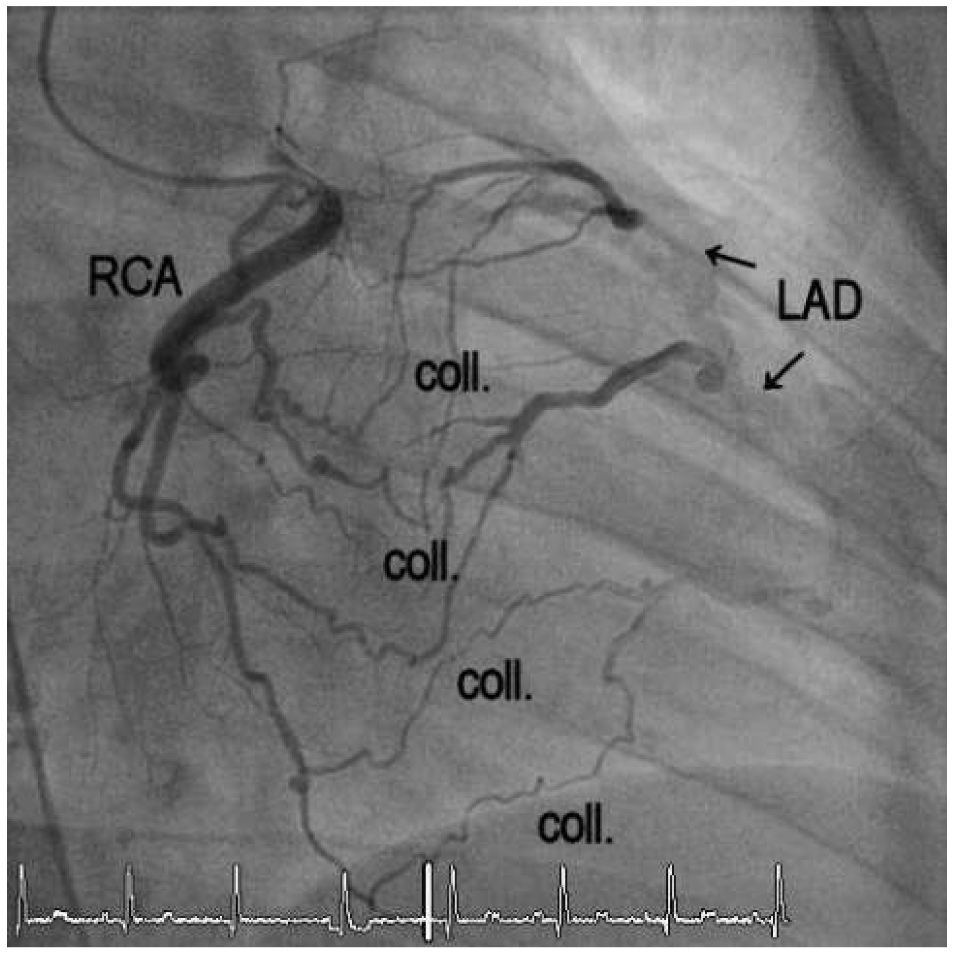 Cardiovascmed 16 00247 g002
