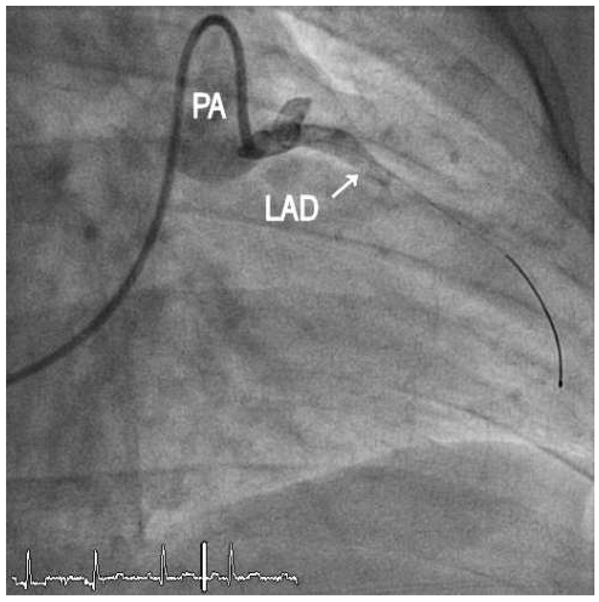 Cardiovascmed 16 00247 g003