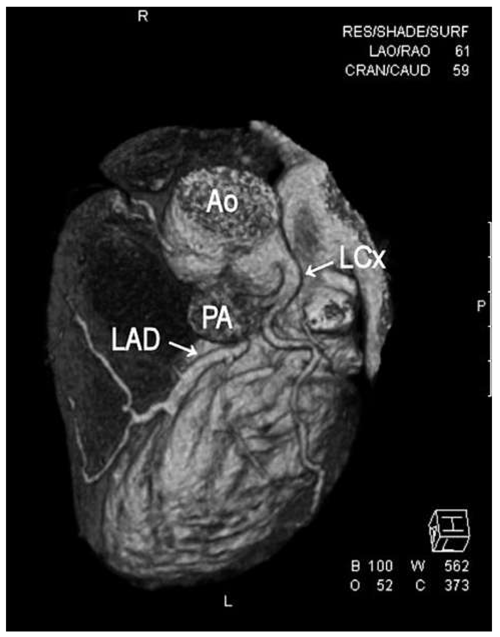 Cardiovascmed 16 00247 g004