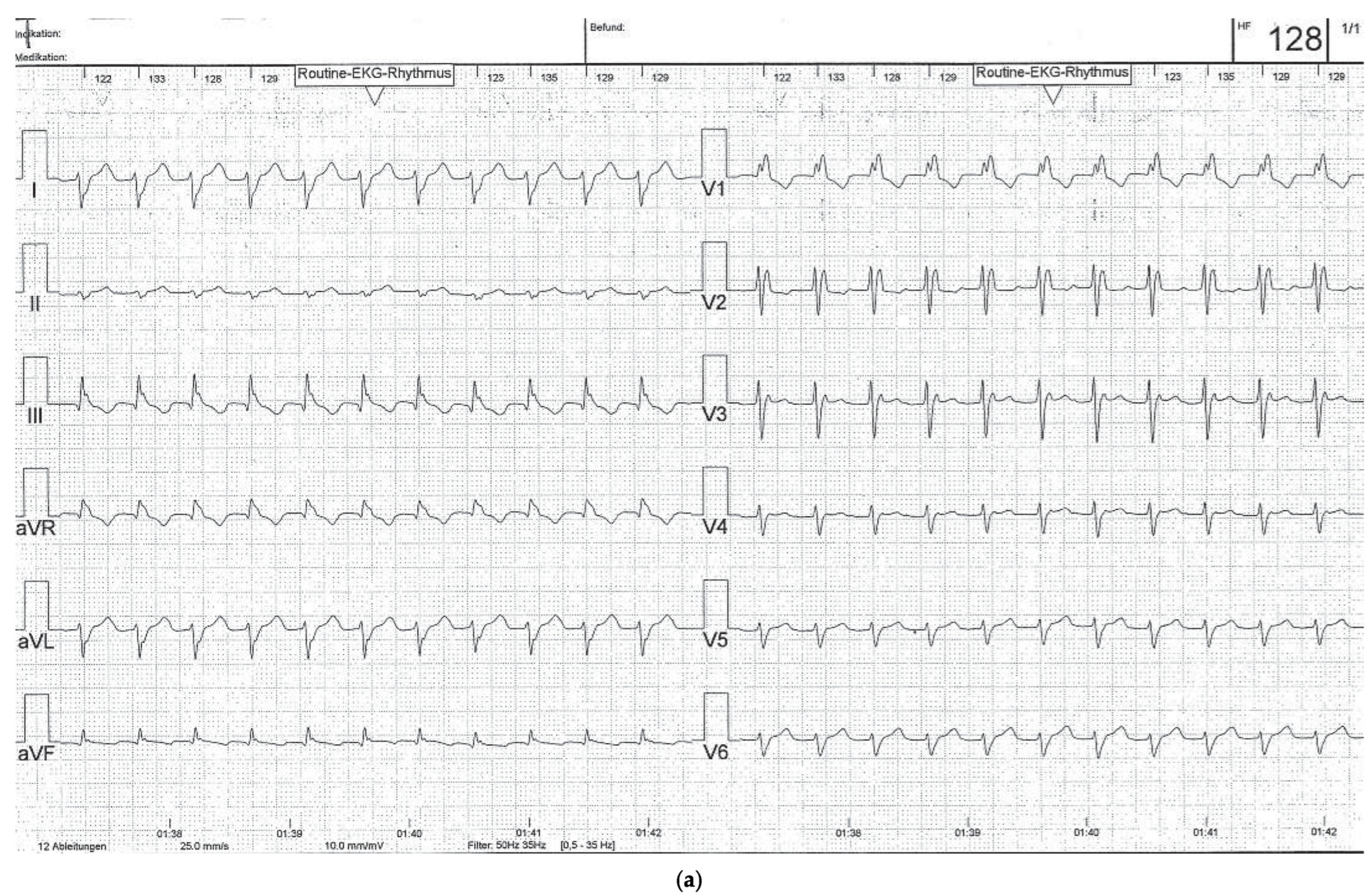 Cardiovascmed 16 00250 g001a